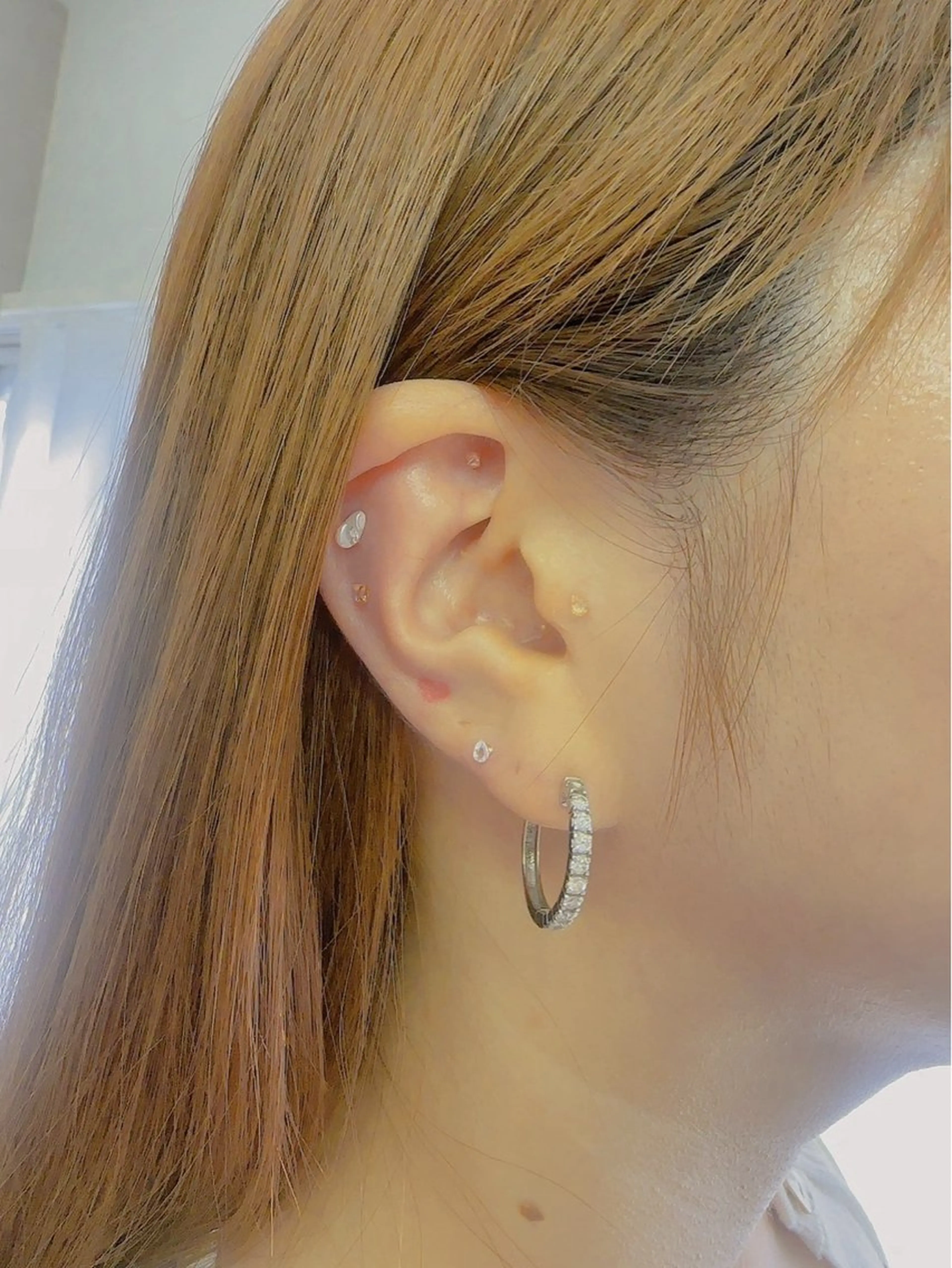 Relimi所属・肌育・ニキビケア ルリミ　TAEのエステ・リラクイメージ