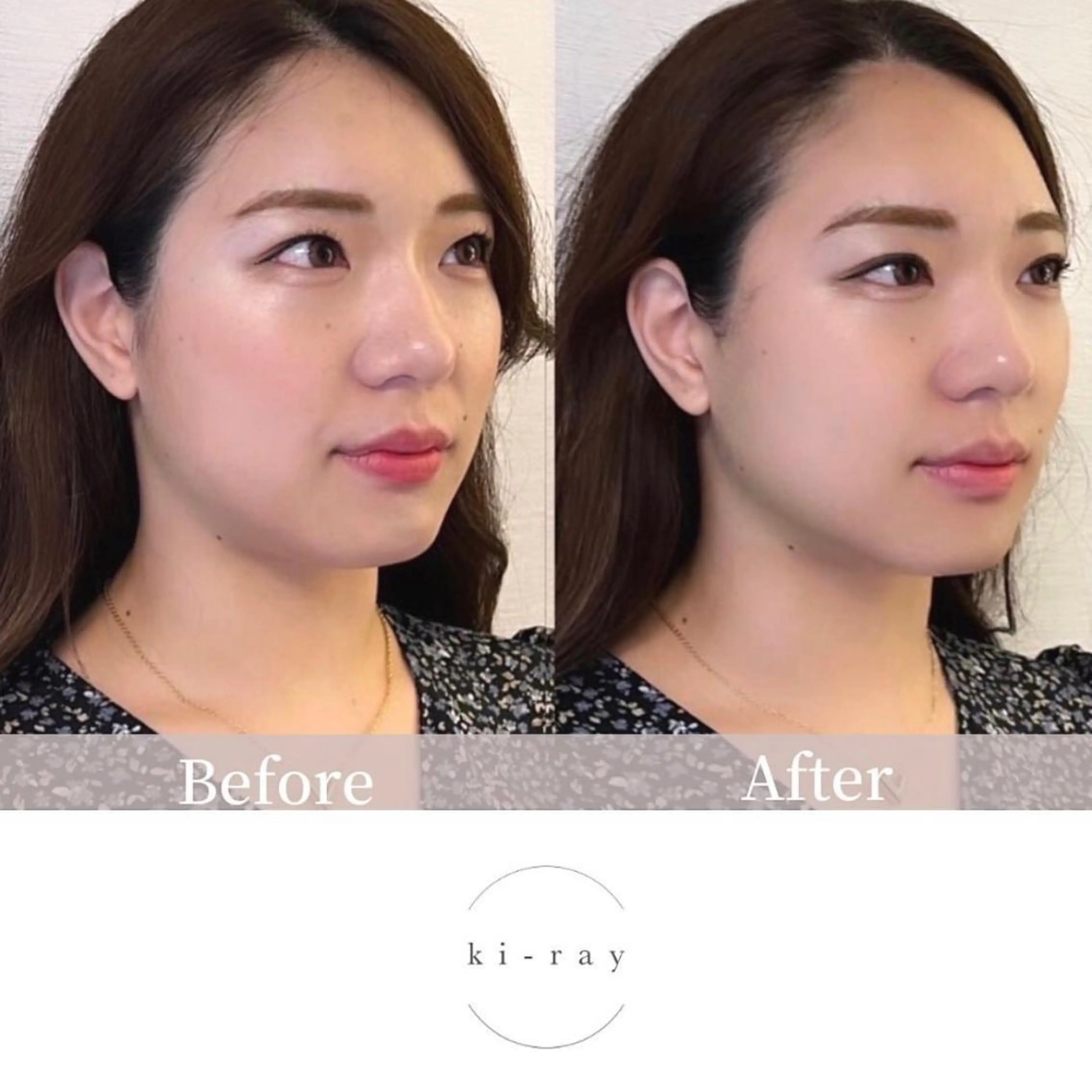 綺麗のひみつ グランプリ受賞店のエステ・リラクイメージ