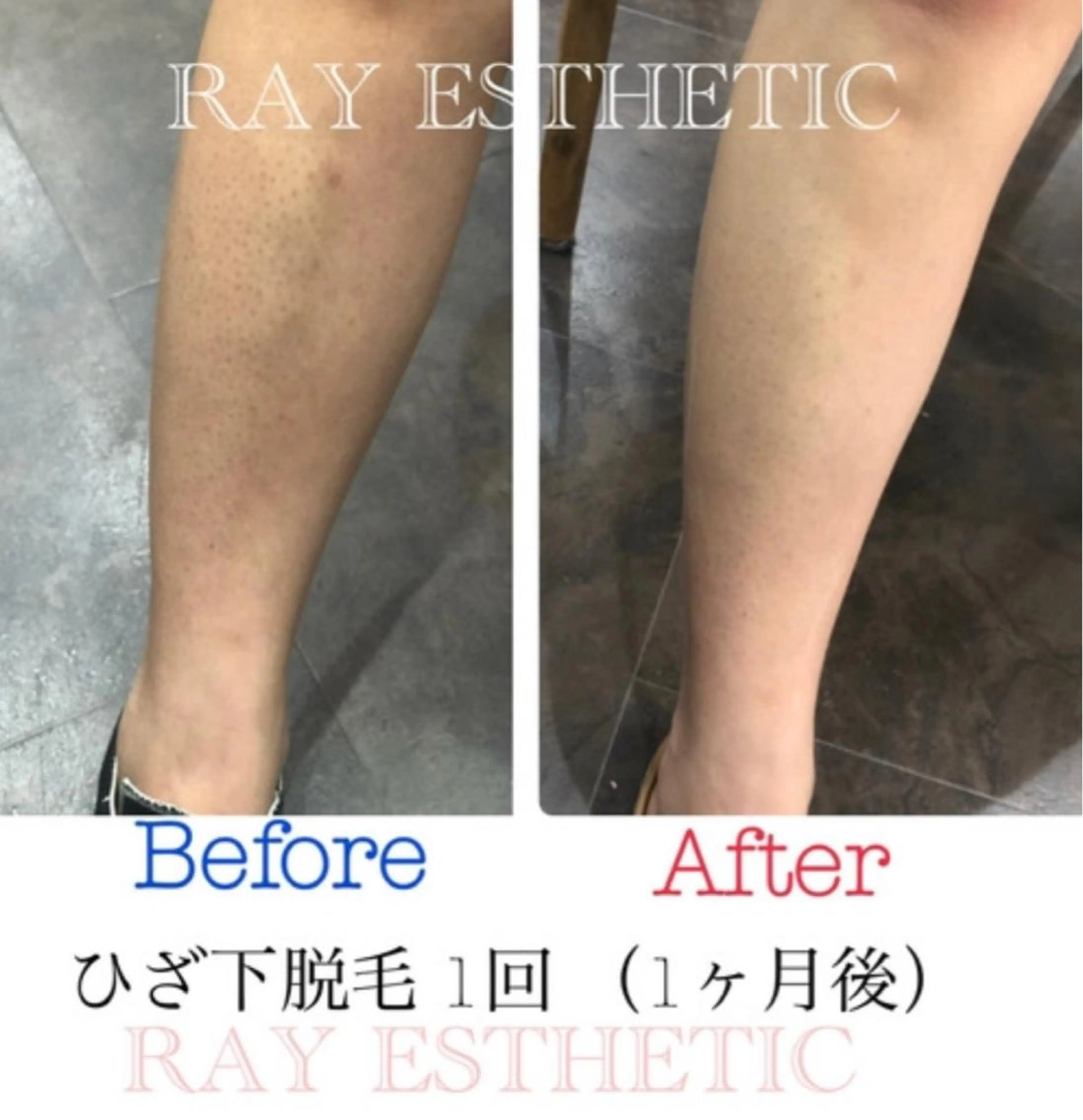 ネイル マツエク・マツパ レイフィールド江南店所属・レイエステティック 江南店のエステ・リラクイメージ