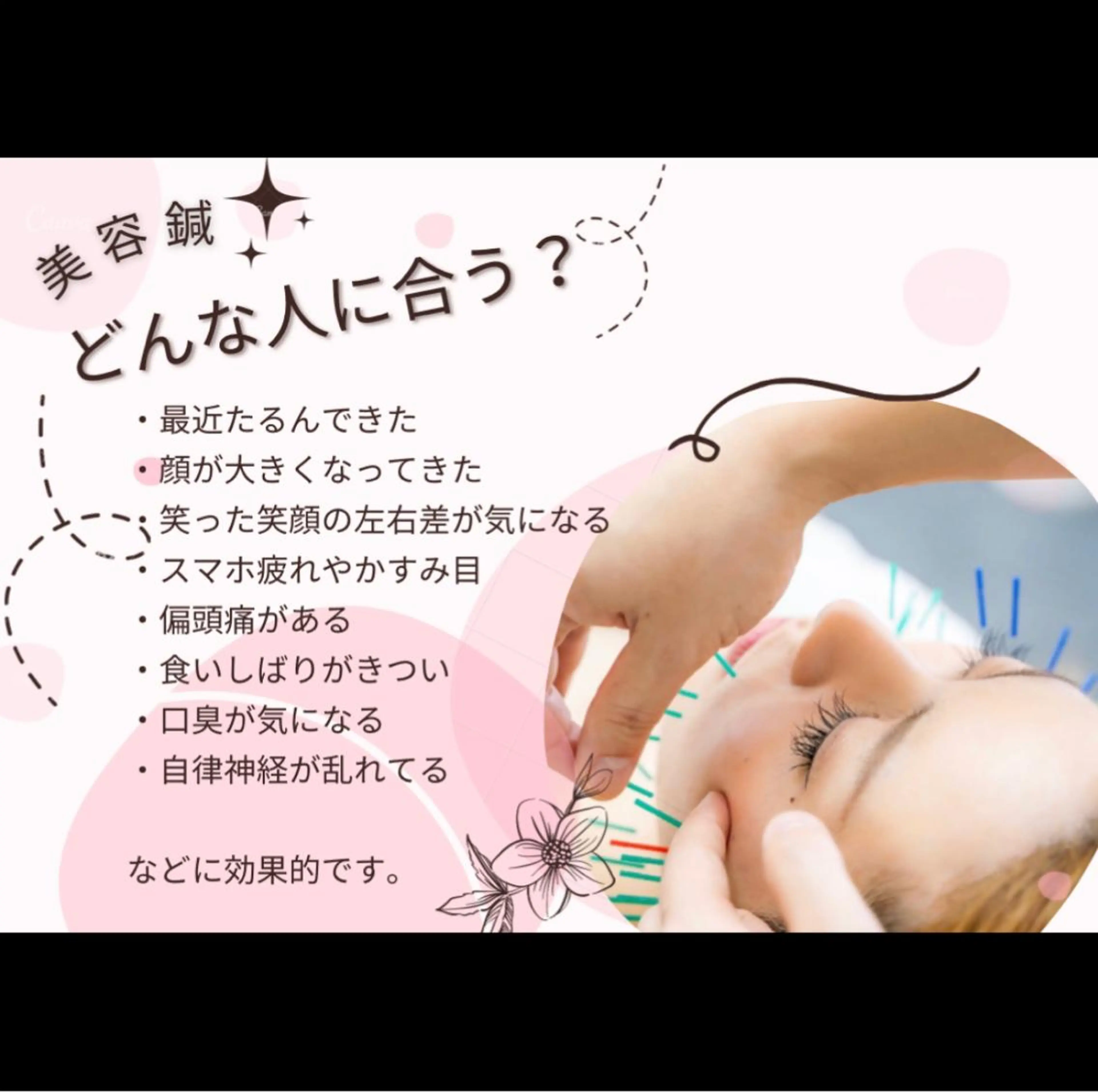 その他 つばさ所属・マッツンの 鍼のその他イメージ