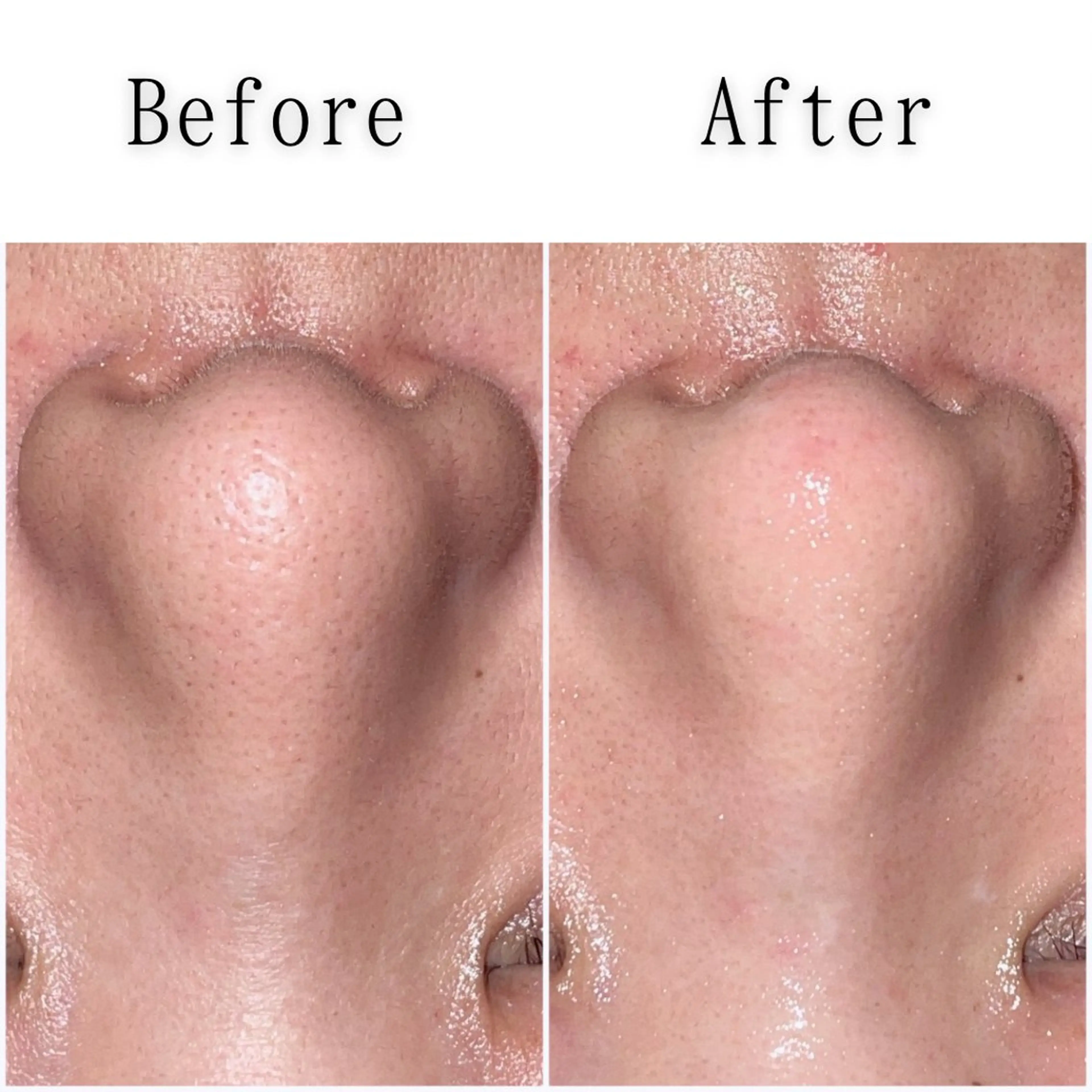 エステ SELF  BEAUTY gracia浦添店所属・gracia 浦添店のその他イメージ