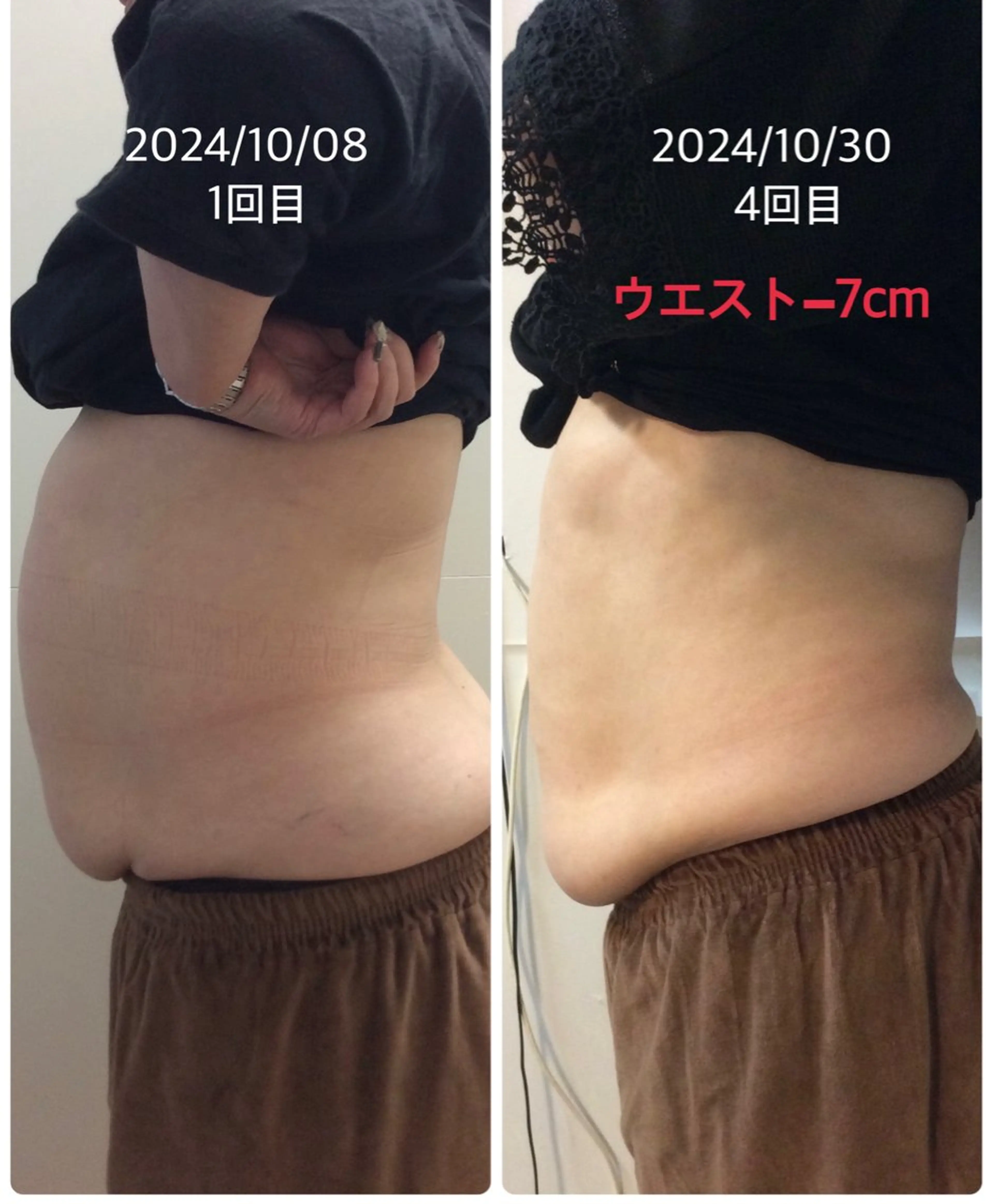 【men'sもOK】オールハンド痩身　お腹50分の写真