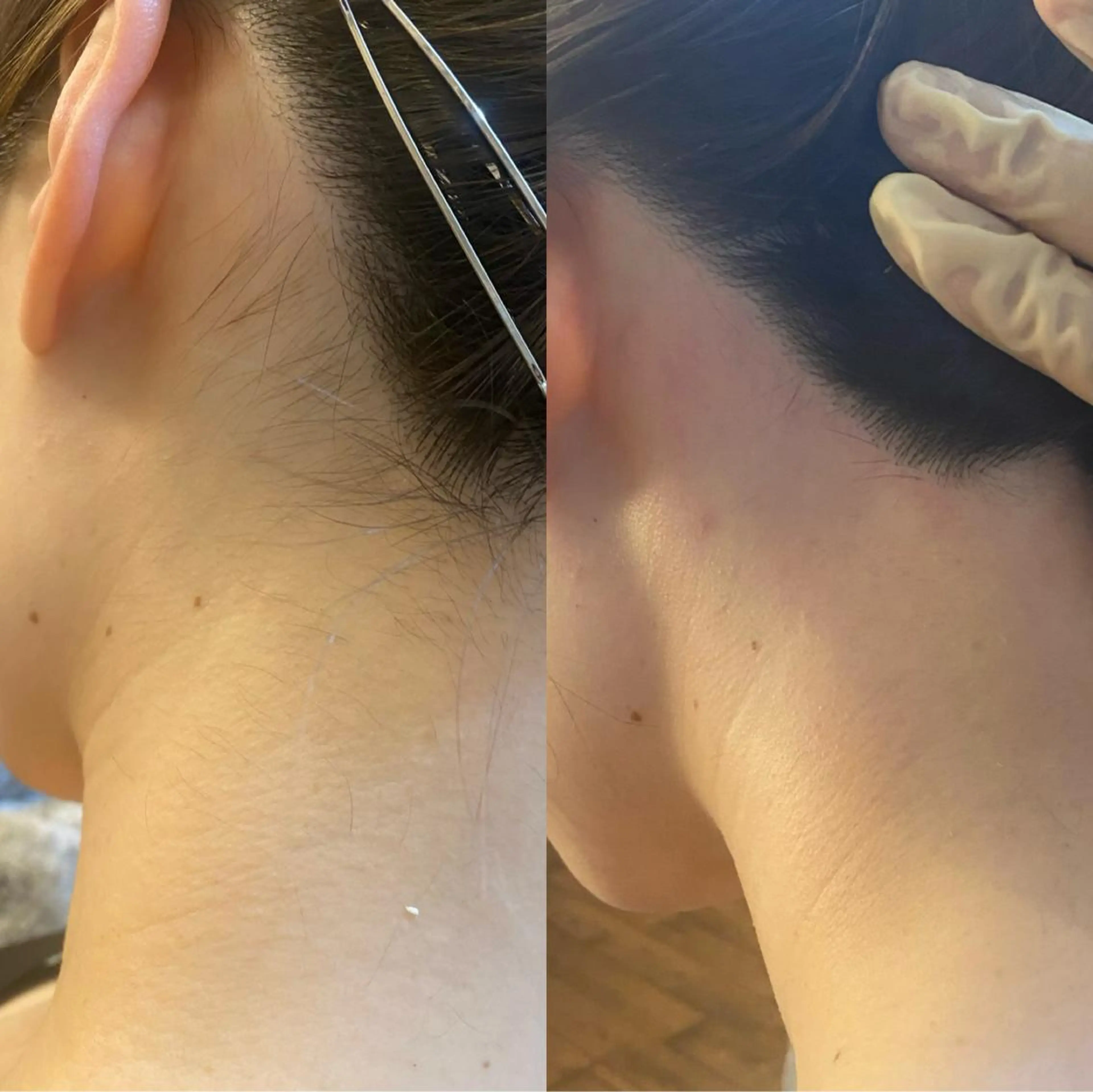 脱毛 BELCIA福岡店　récolte de BELCIA（レコルトデベルシア）所属・BELCIA福岡店 レコルトデベルシアのエステ・リラクイメージ