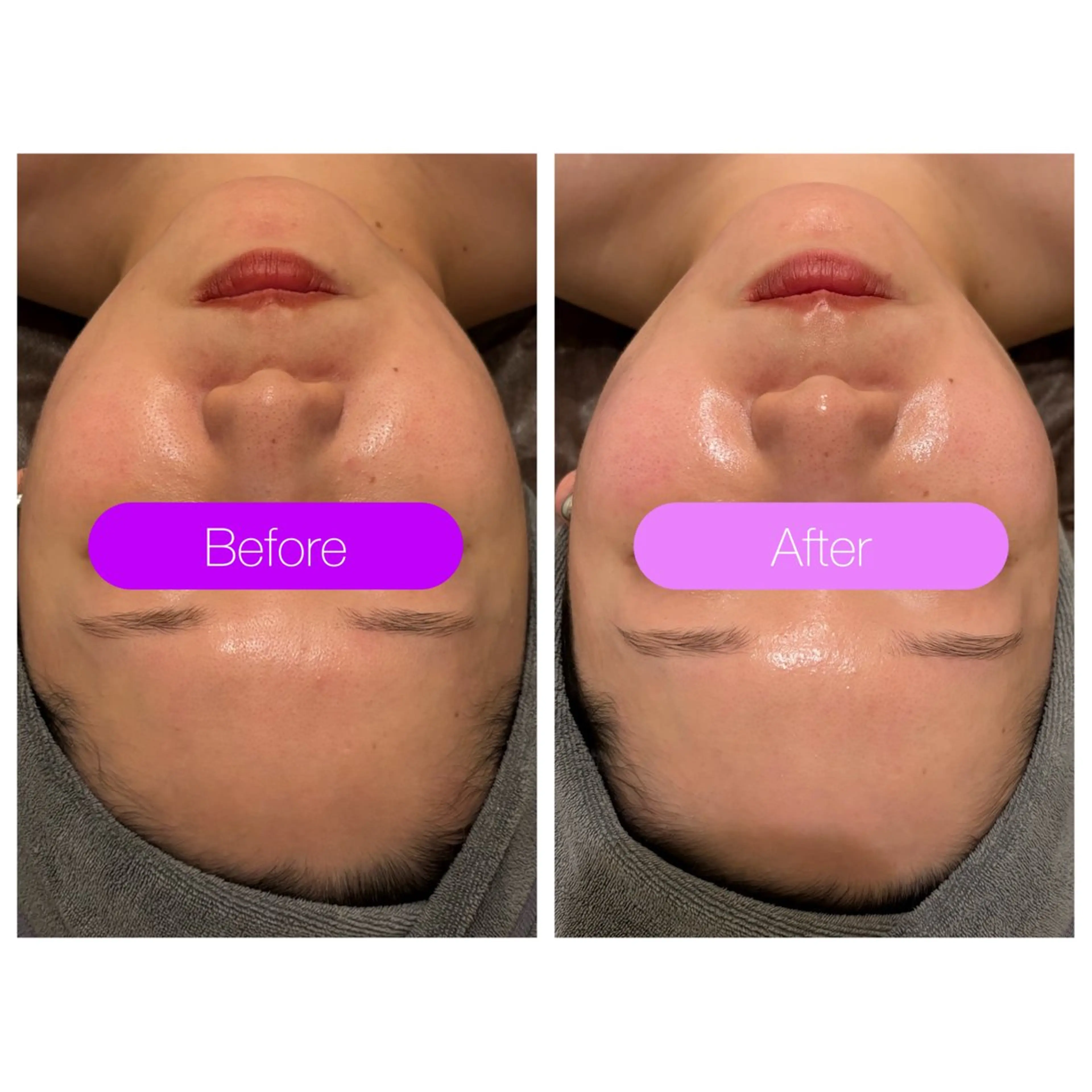 エステ 肌質管理/小顔コルギ ☆表参道/外苑前のエステ・リラクイメージ