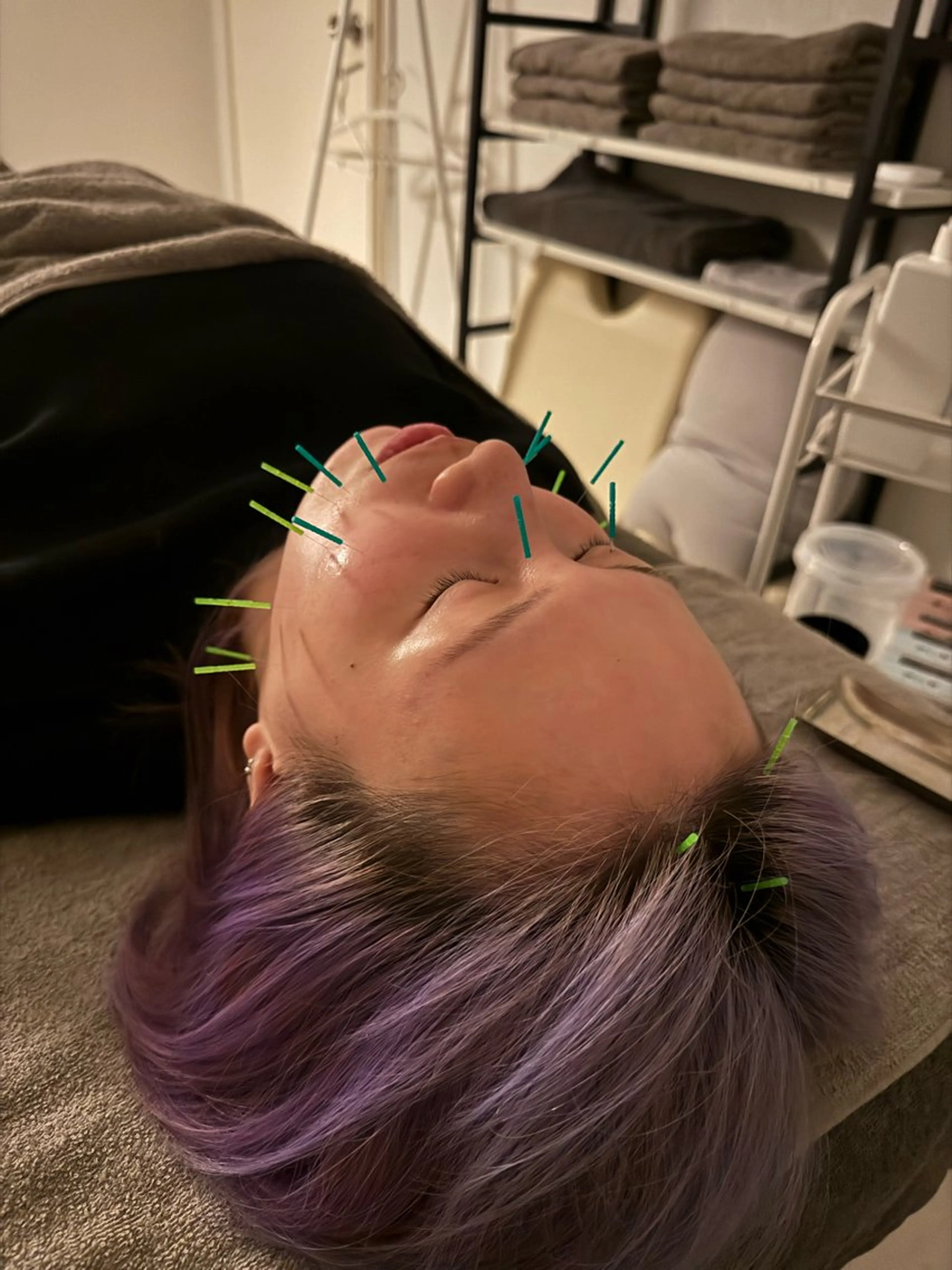 美容鍼×小顔矯正 ×美容整体　浜川泰仁のエステ・リラクイメージ