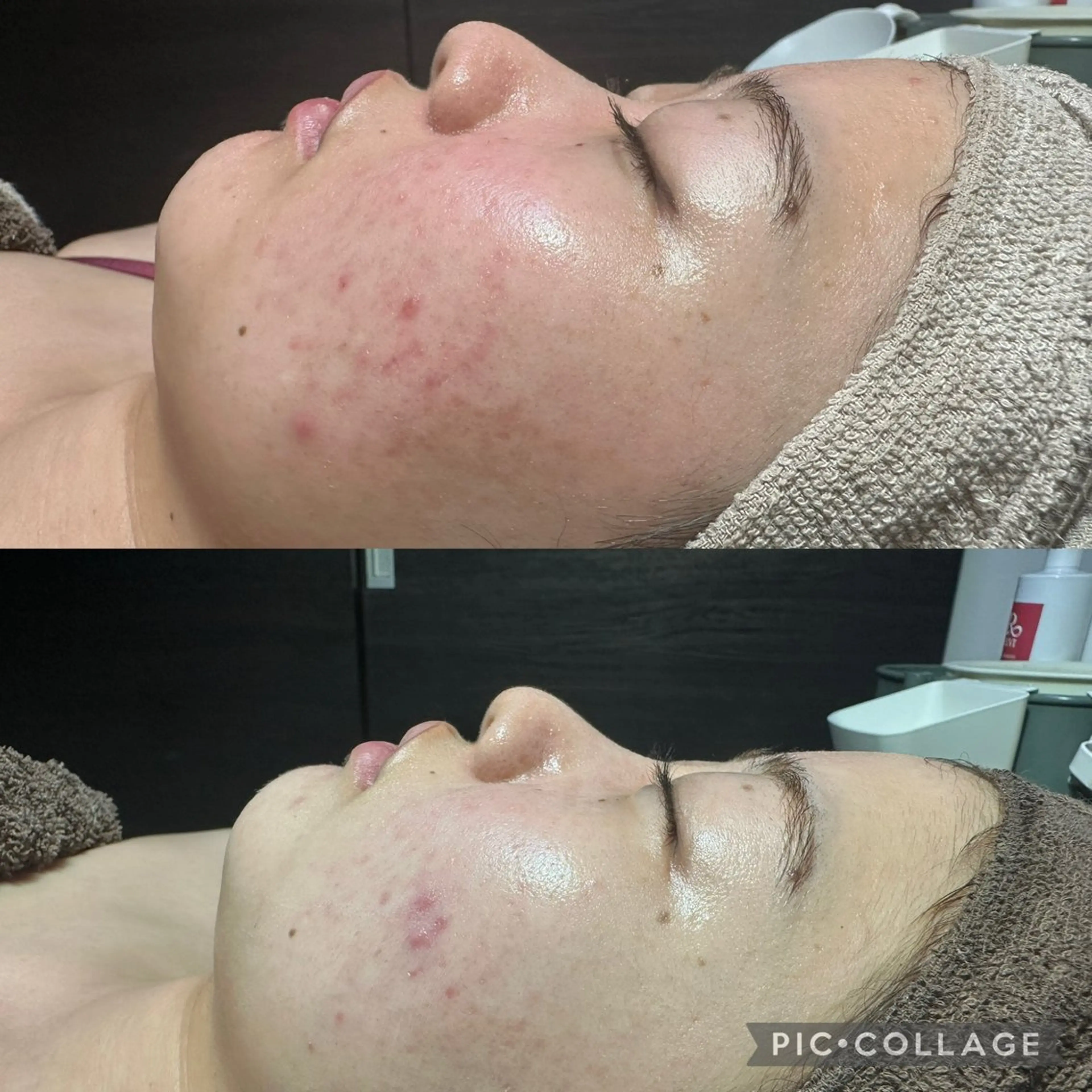 エステ エステ✖️ネイル Feelのネイルデザイン