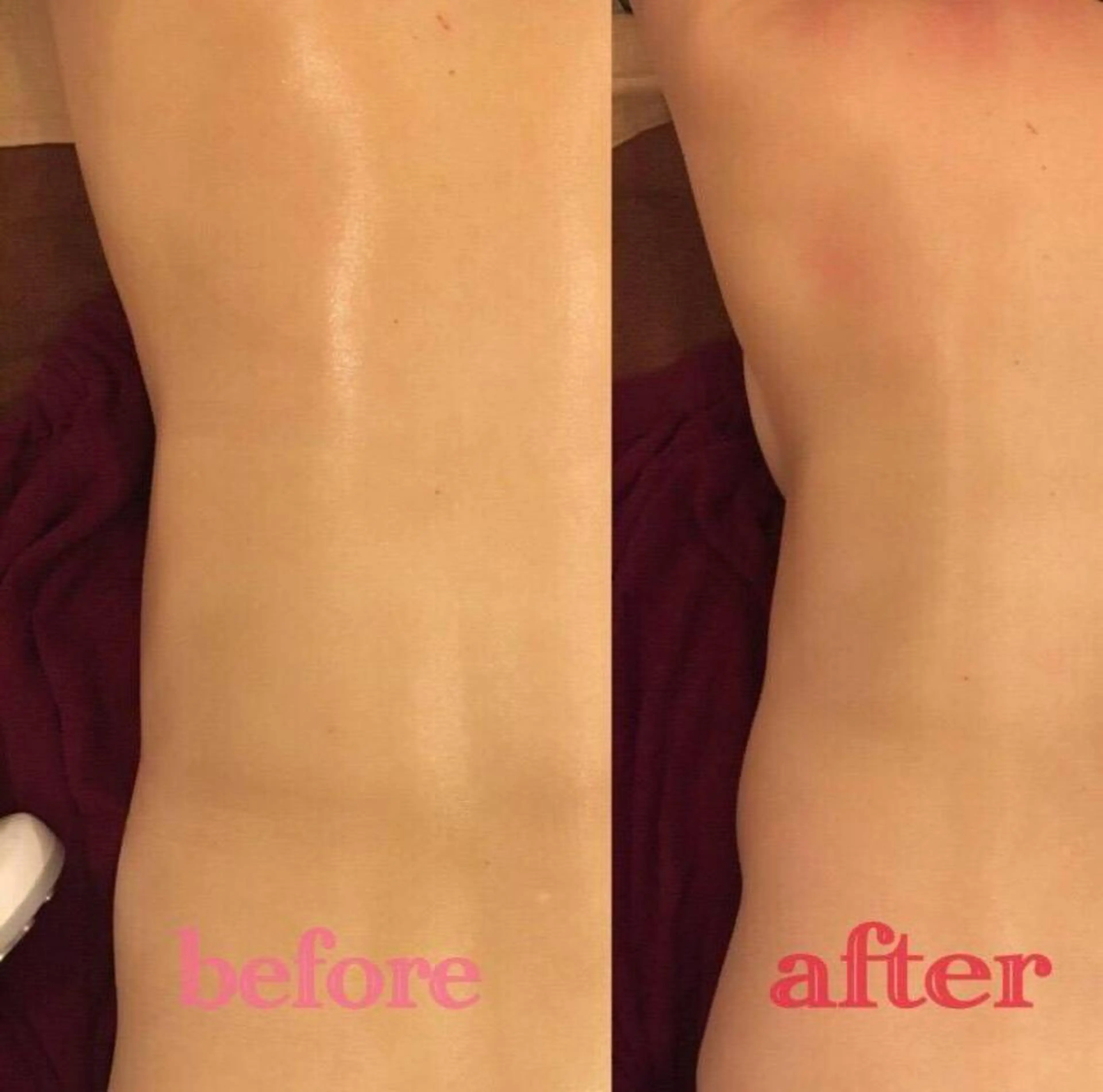 HappIness 遠赤外線ドームのエステ・リラクイメージ