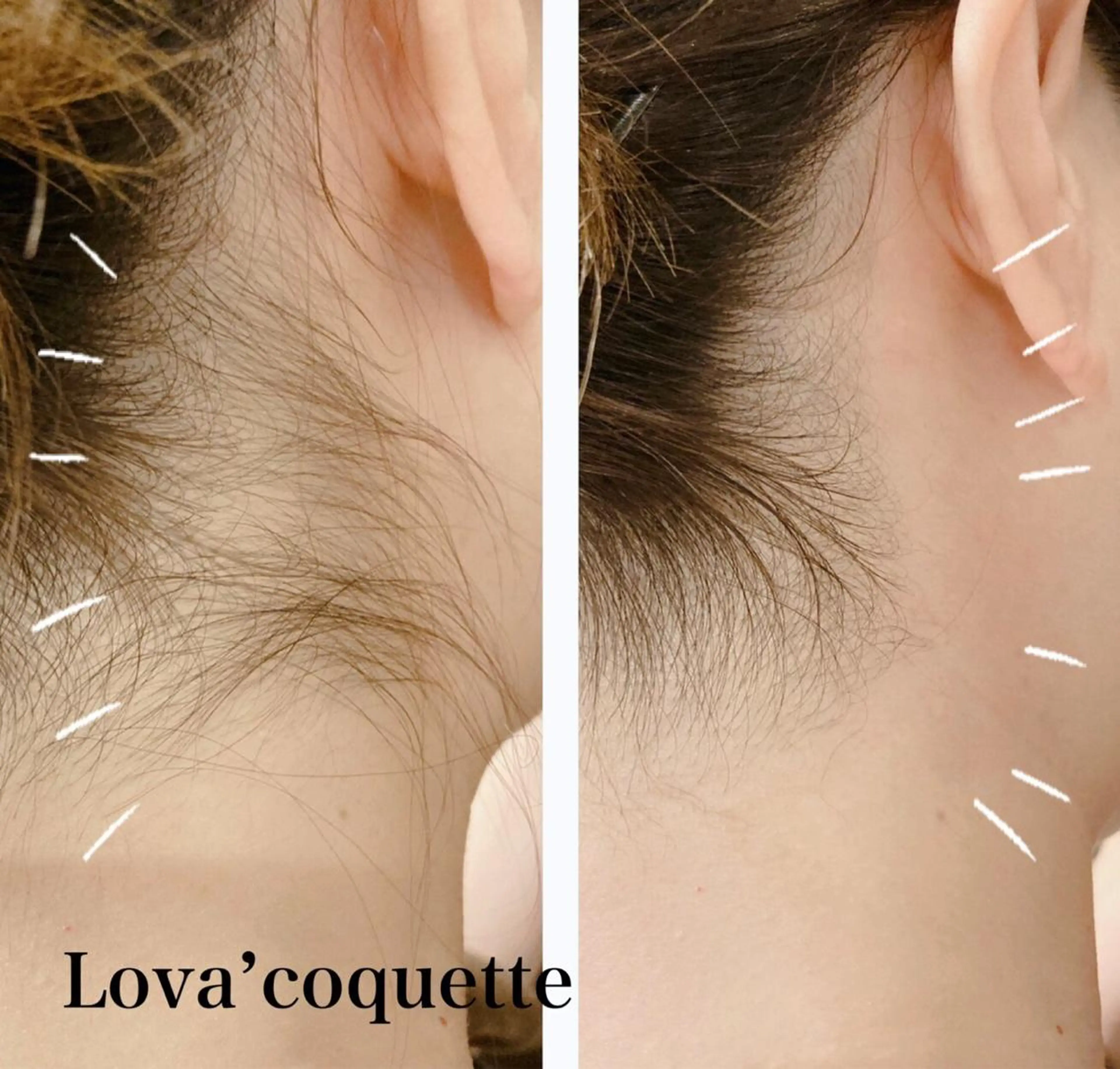 ラヴァコケット 梅田店のエステ・リラクイメージ