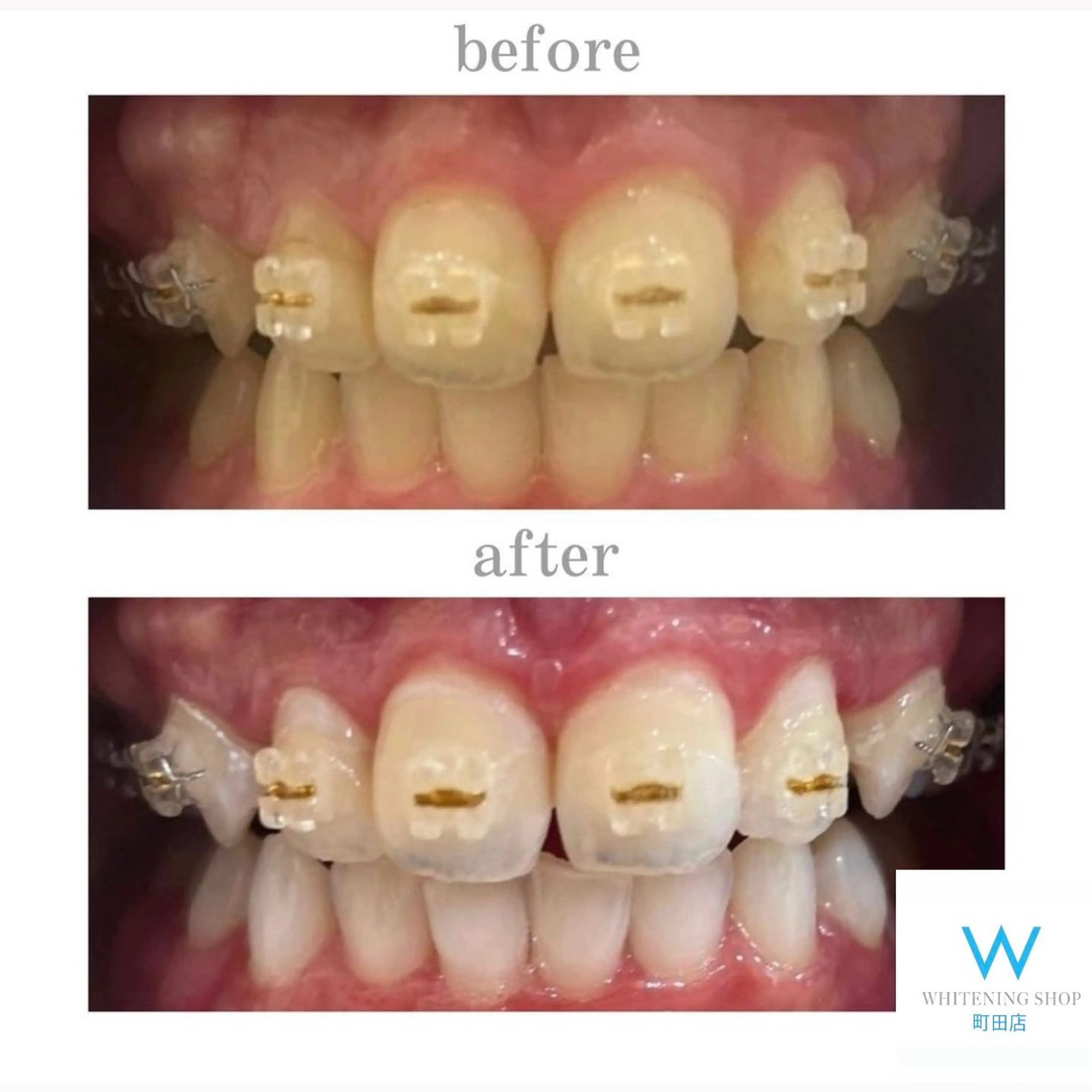 メンズ キッズ その他 ホワイトニング ショップ町田店のその他イメージ