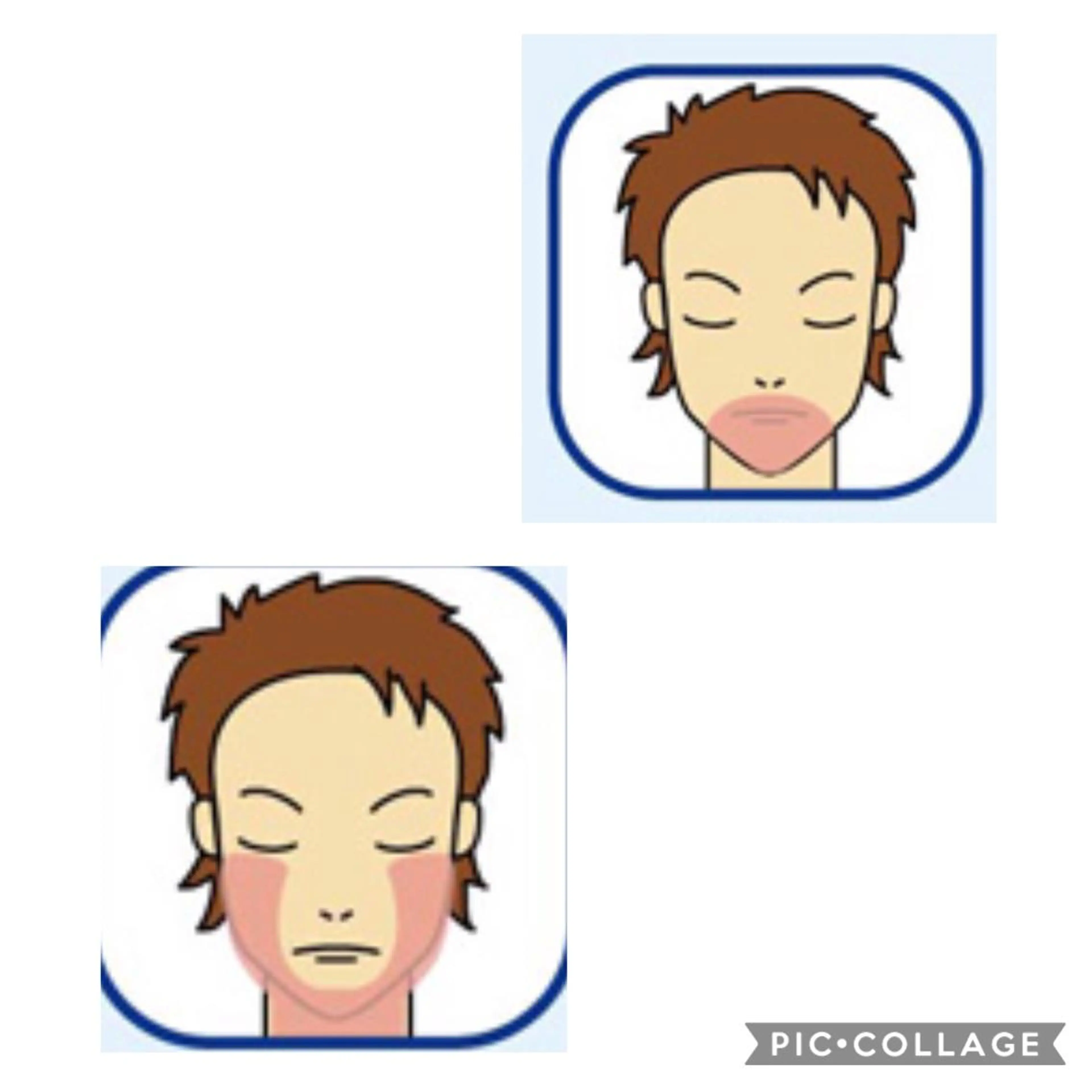 1番人気🥇メンズヒゲ脱毛パック付きセット🉐¥2200の写真