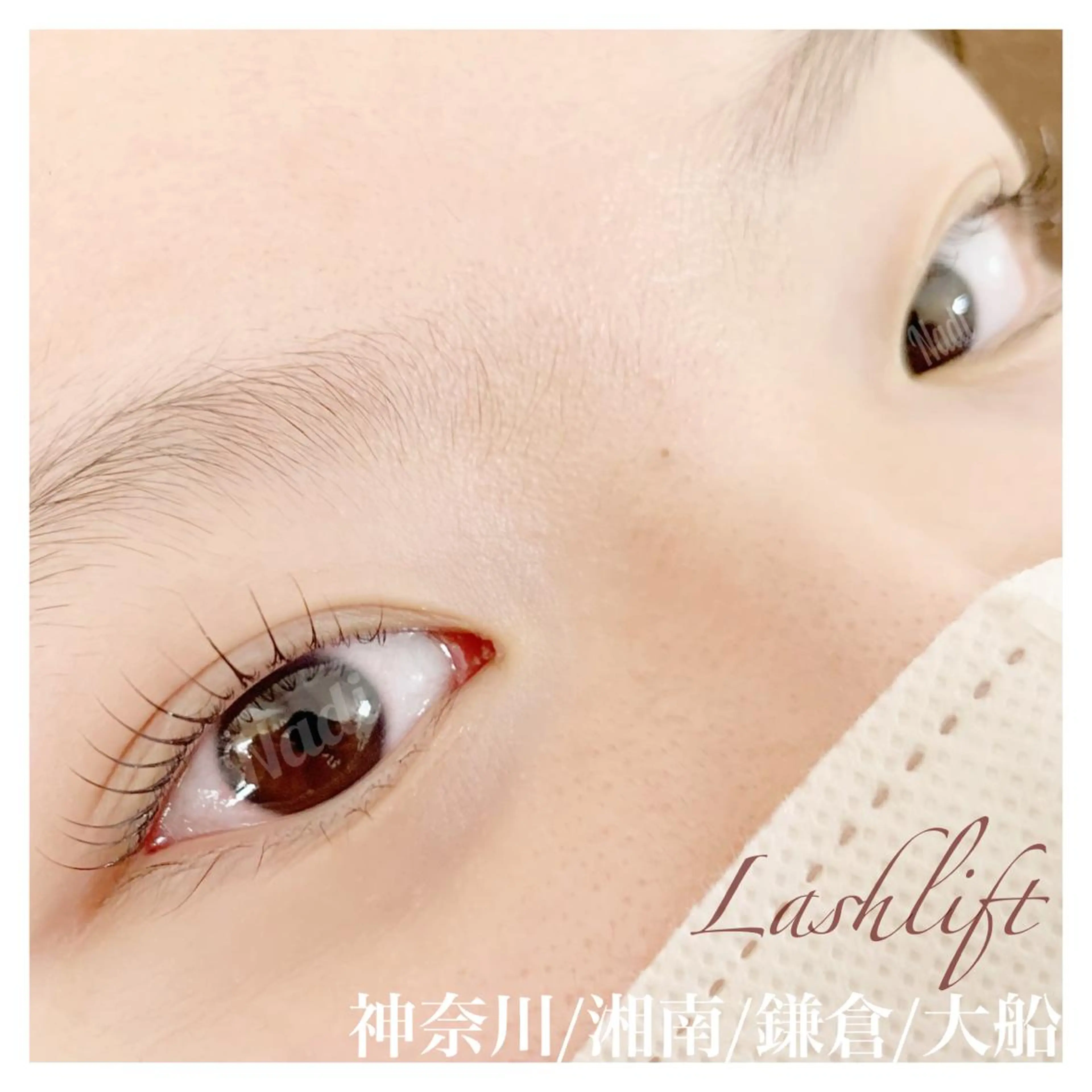 マツエク・マツパ ハーブピーリング専門EMILUCA藤沢所属・ハーブピーリング /KAEDEのエステ・リラクイメージ