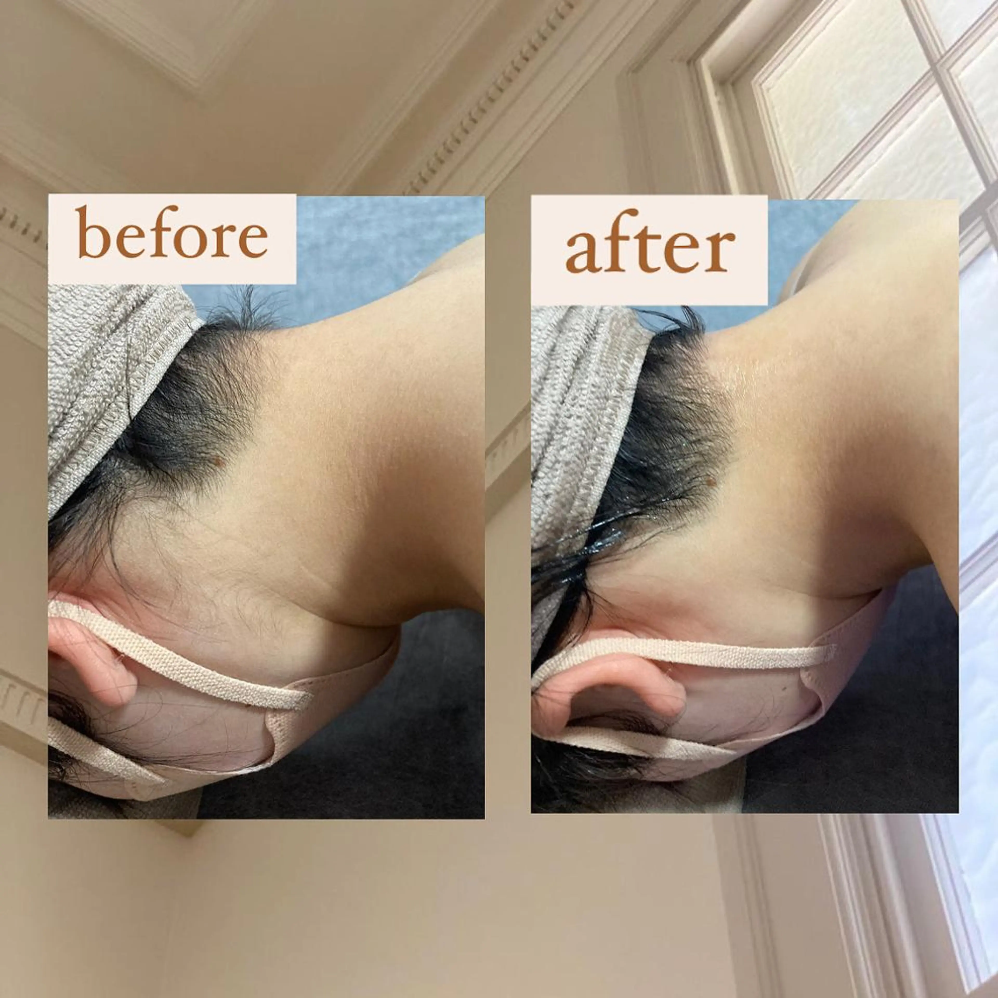 脱毛 crescent所属・【韓国肌管理・脱毛】 クレセントのその他イメージ