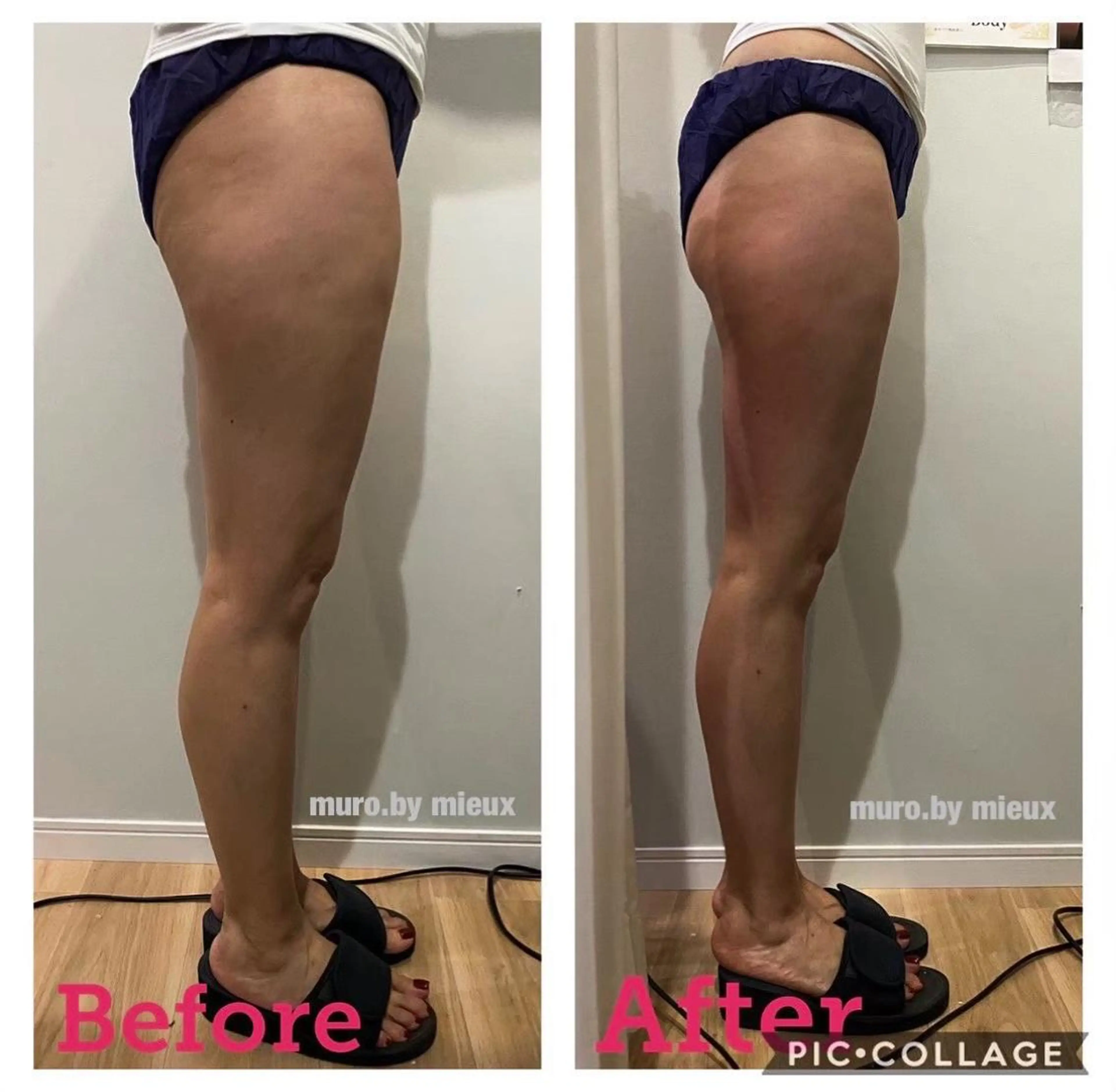 ハーブピーリング専門 muro.のエステ・リラクイメージ