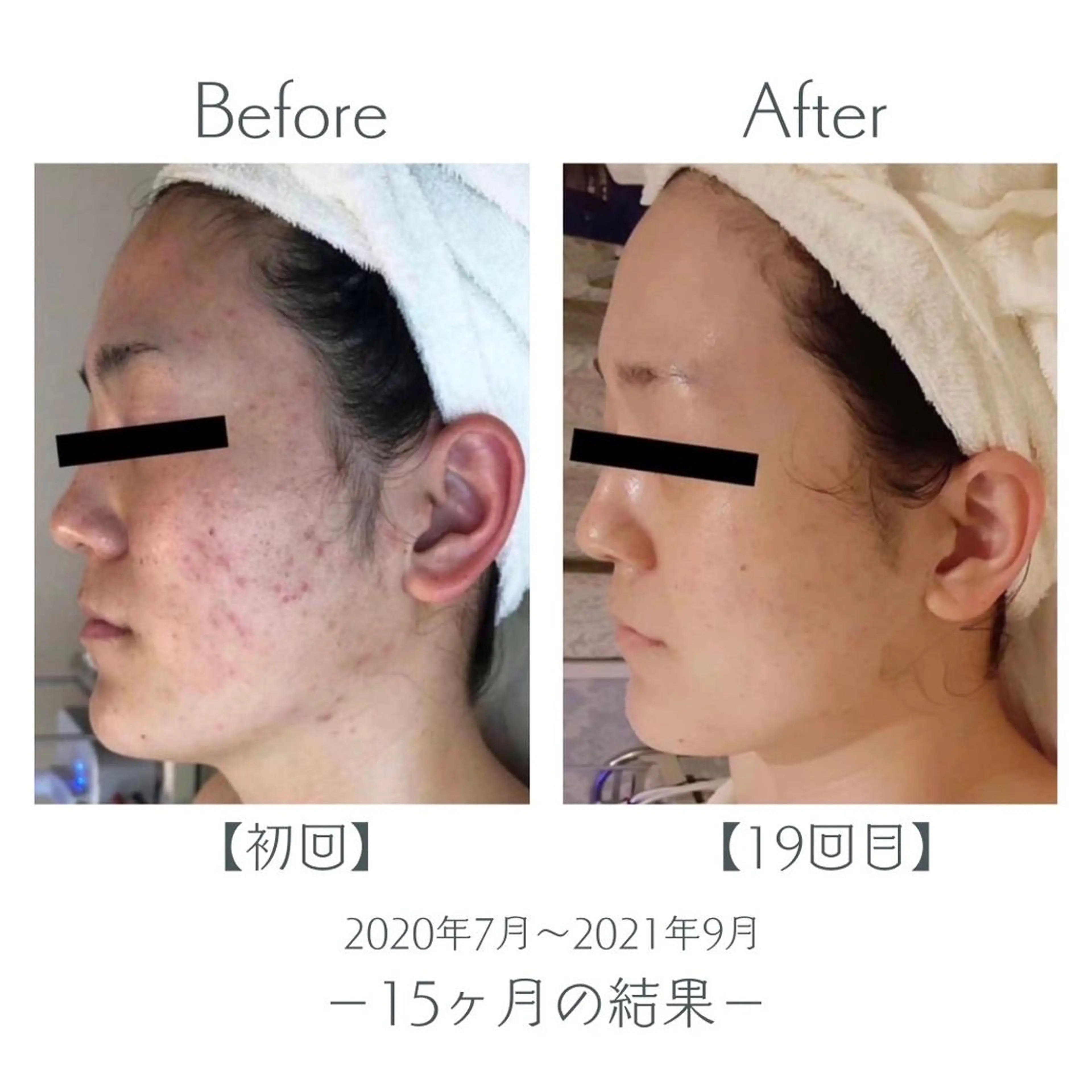 エステ＆美肌脱毛 ココサロ倉敷店のエステ・リラクイメージ