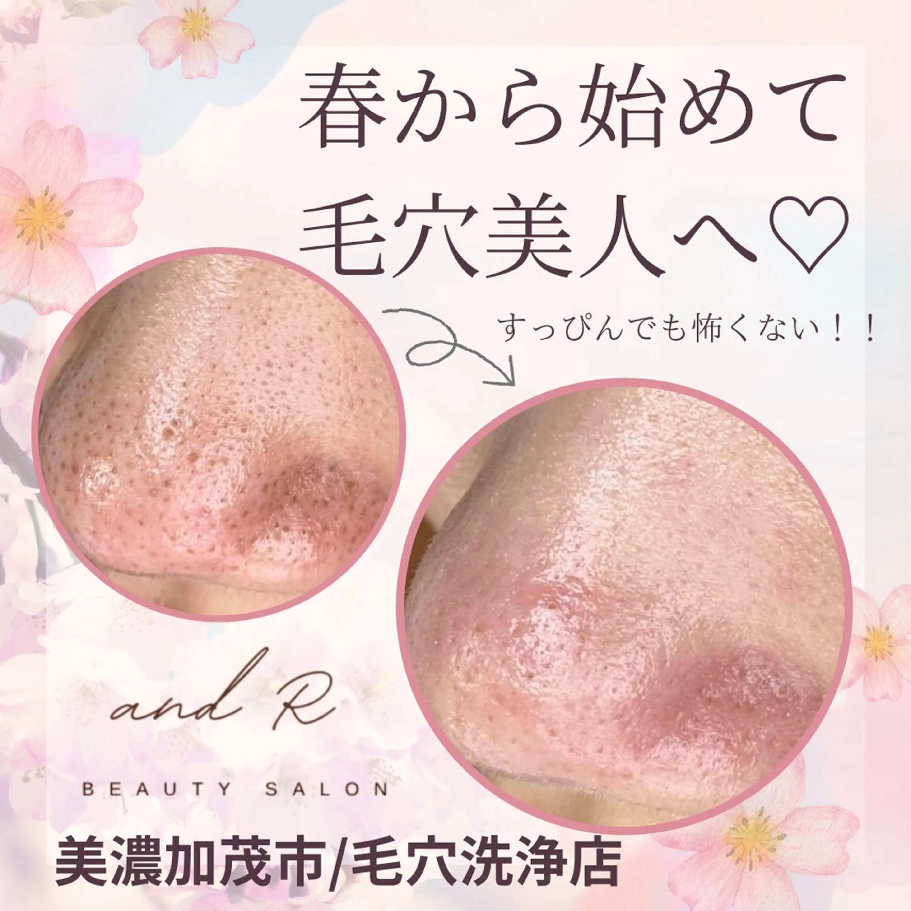 and R 男女 脱毛、毛穴サロンのエステ・リラクイメージ