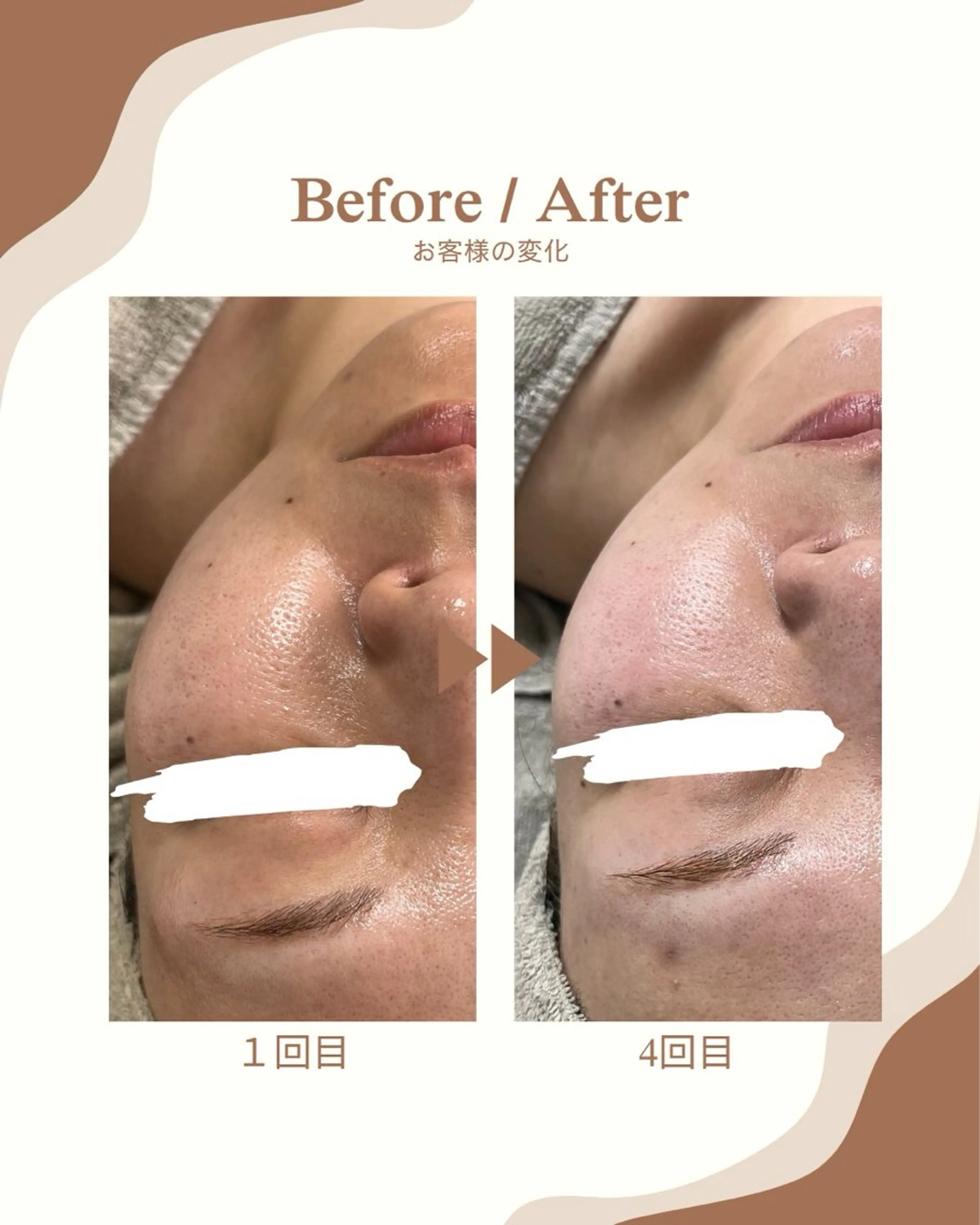 エステ 1st｜フェイシャル エステ専門店のエステ・リラクイメージ