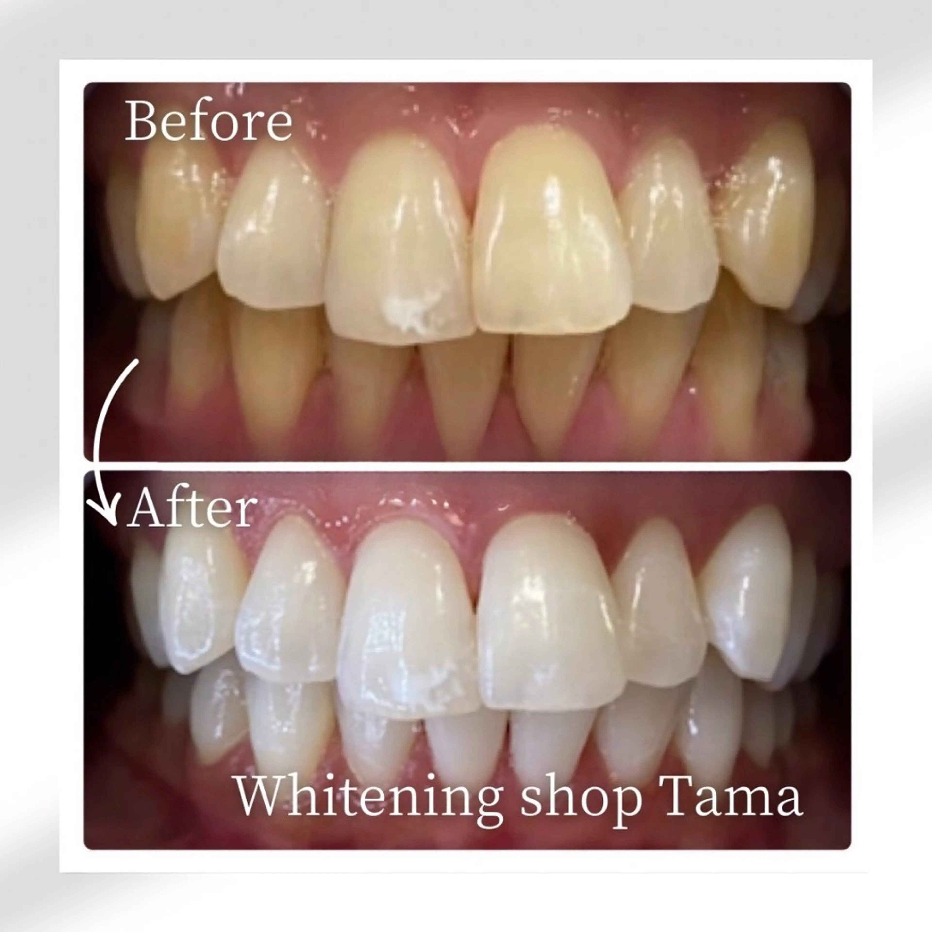 メンズ ホワイトニング ショップ多摩店のその他イメージ