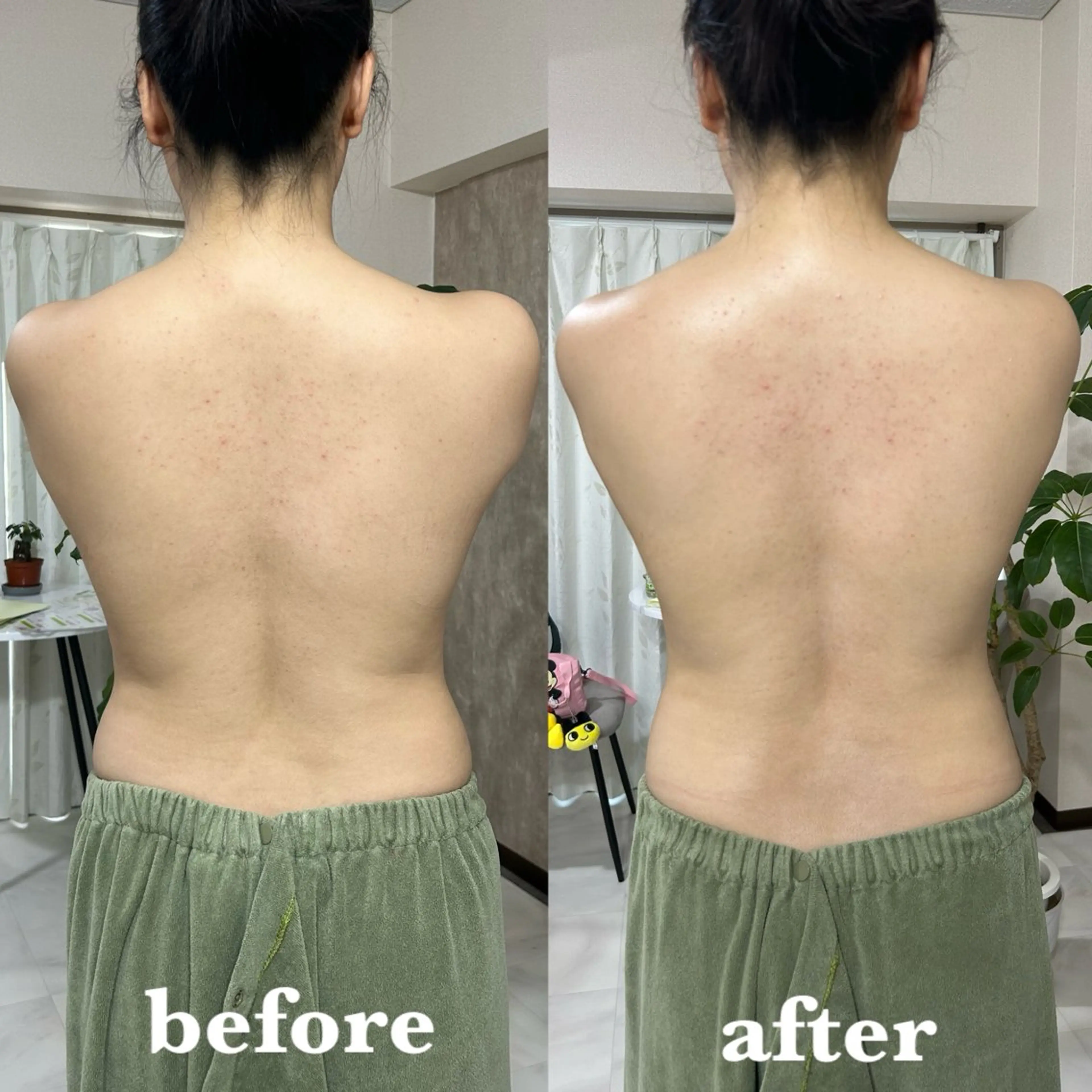 【肌質改善サロン】 リーフィアのエステ・リラクイメージ