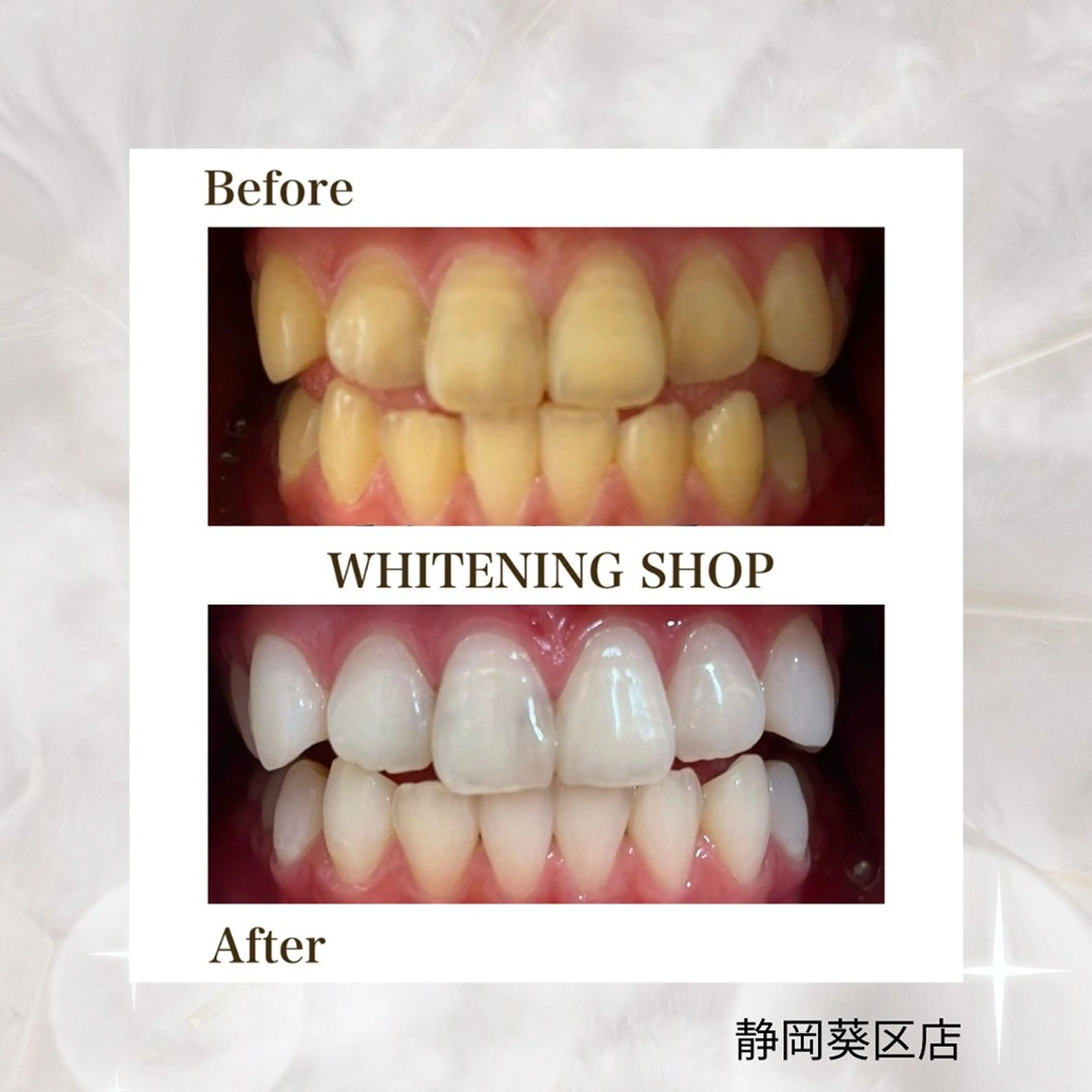 ホワイトニングショップ静岡葵区店所属・ホワイトニング ショップ葵区静岡駅店のその他イメージ