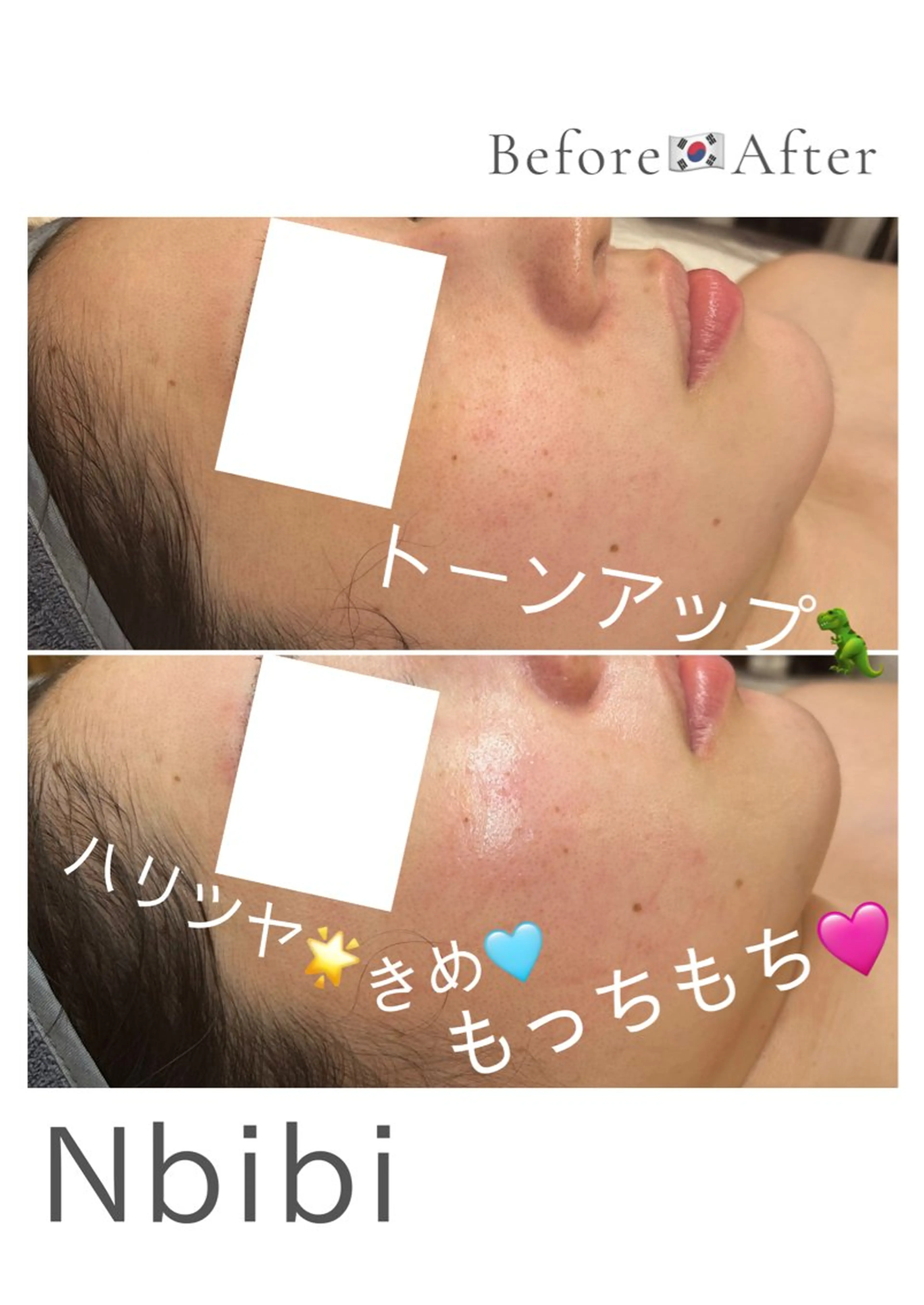 韓国🇰🇷価格 サロン_Nbibiのエステ・リラクイメージ