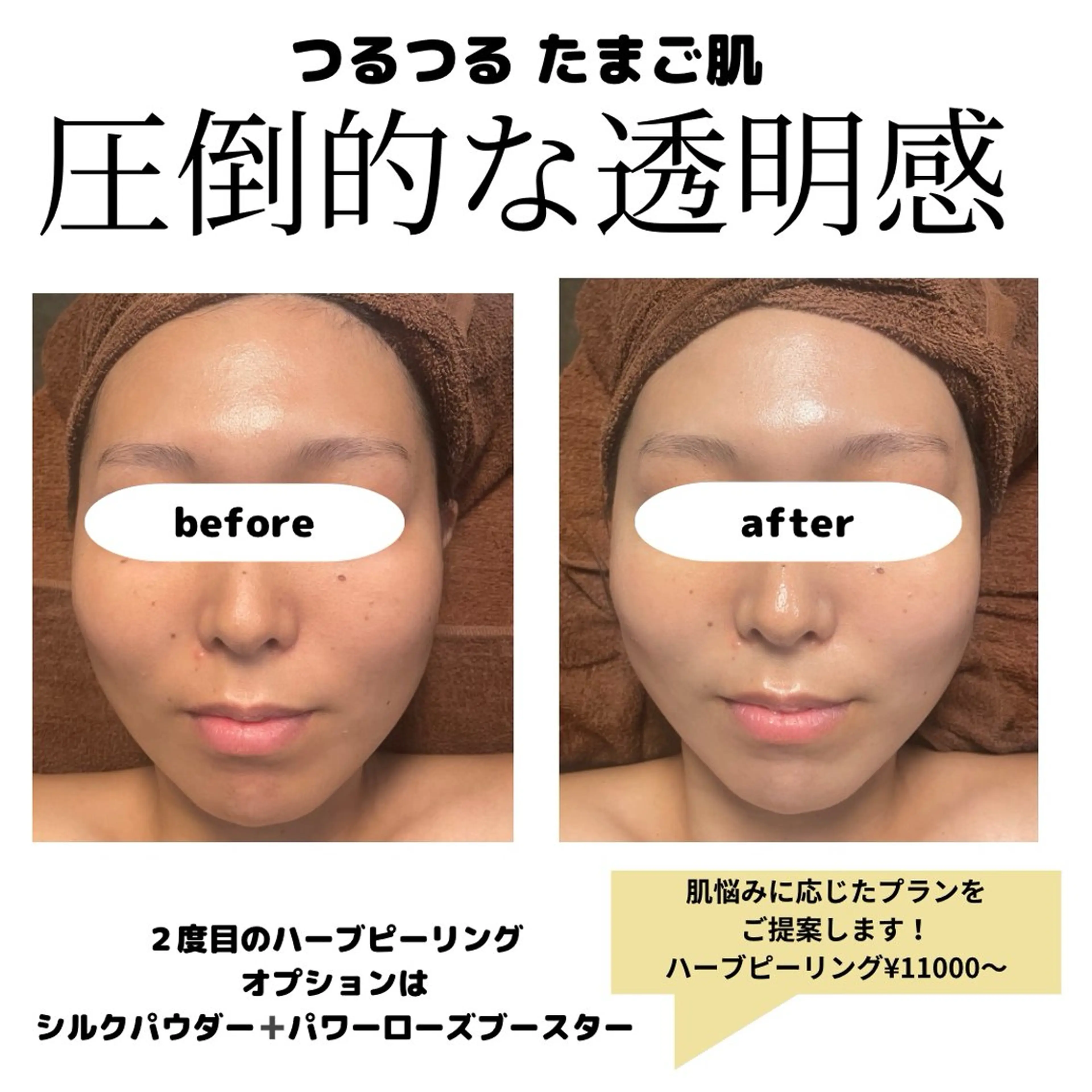 Salon【yuzu.】所属・🍊肌管理×美眉 【yuzu.】の眉毛・アイブロウイメージ