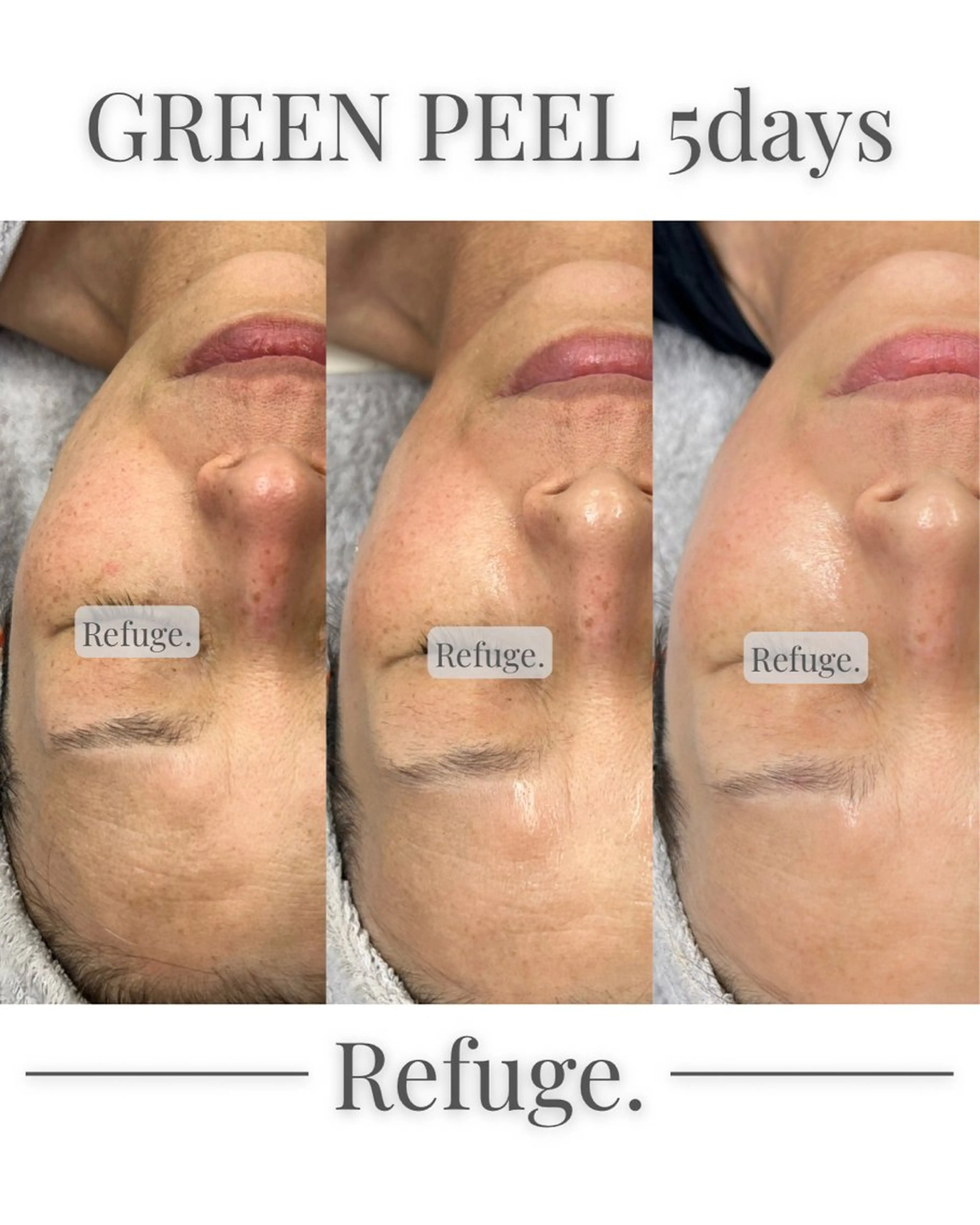 グリーンピール専門サロン Refuge.所属・Refuge. （リフュージュ）のエステ・リラクイメージ