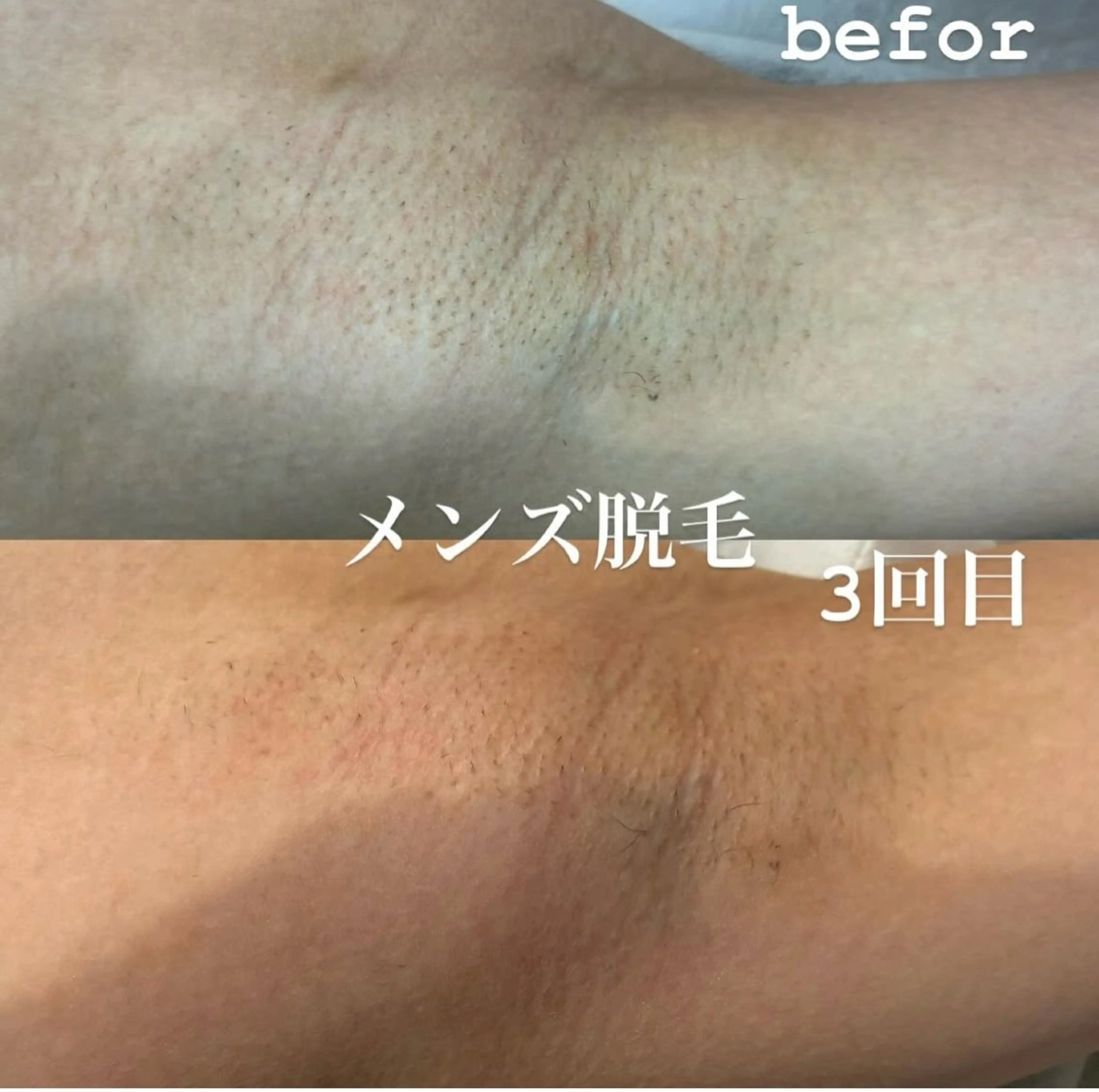 EstheticSalonReTweet所属・竹谷 春希のエステ・リラクイメージ