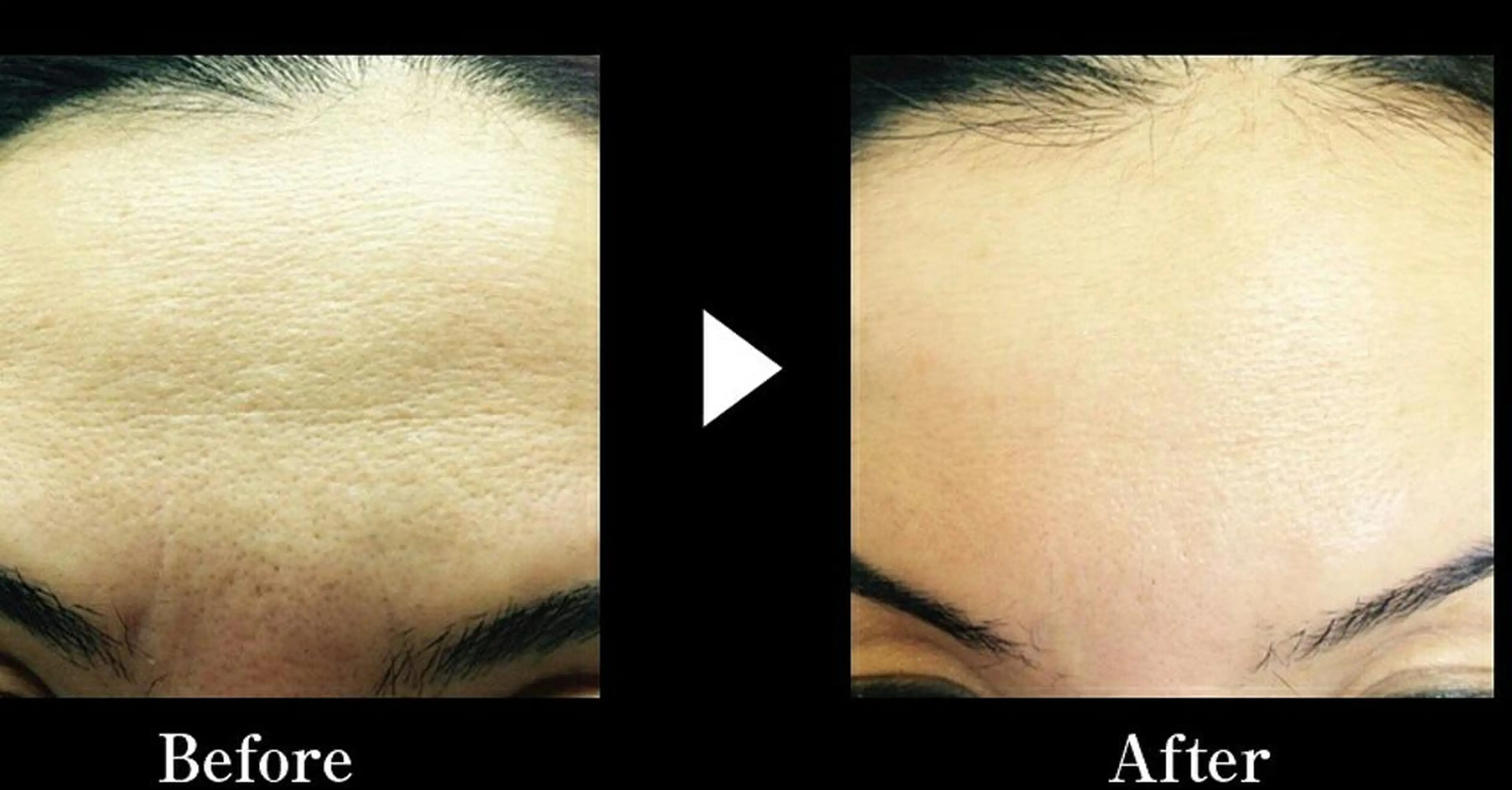 マツエク・マツパ メンズ キッズ ロング カラー ショート ミディアム パーマ ネイル セミロング ヘアアレンジ 次世代まつげパーマは 『リベル名古屋』のマツエク・マツパデザイン