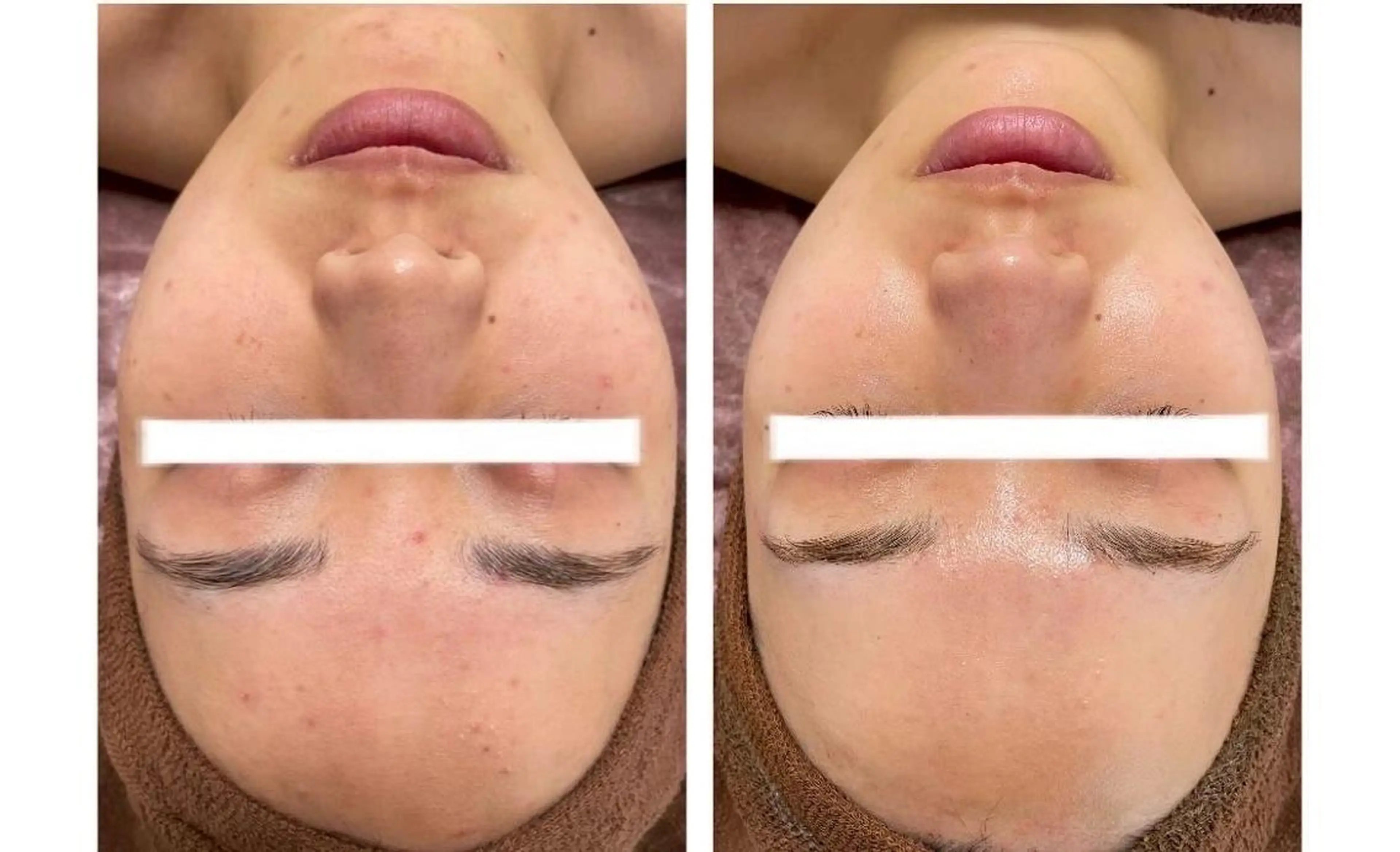 エステ 脱毛×肌管理サロン ルネルのエステ・リラクイメージ