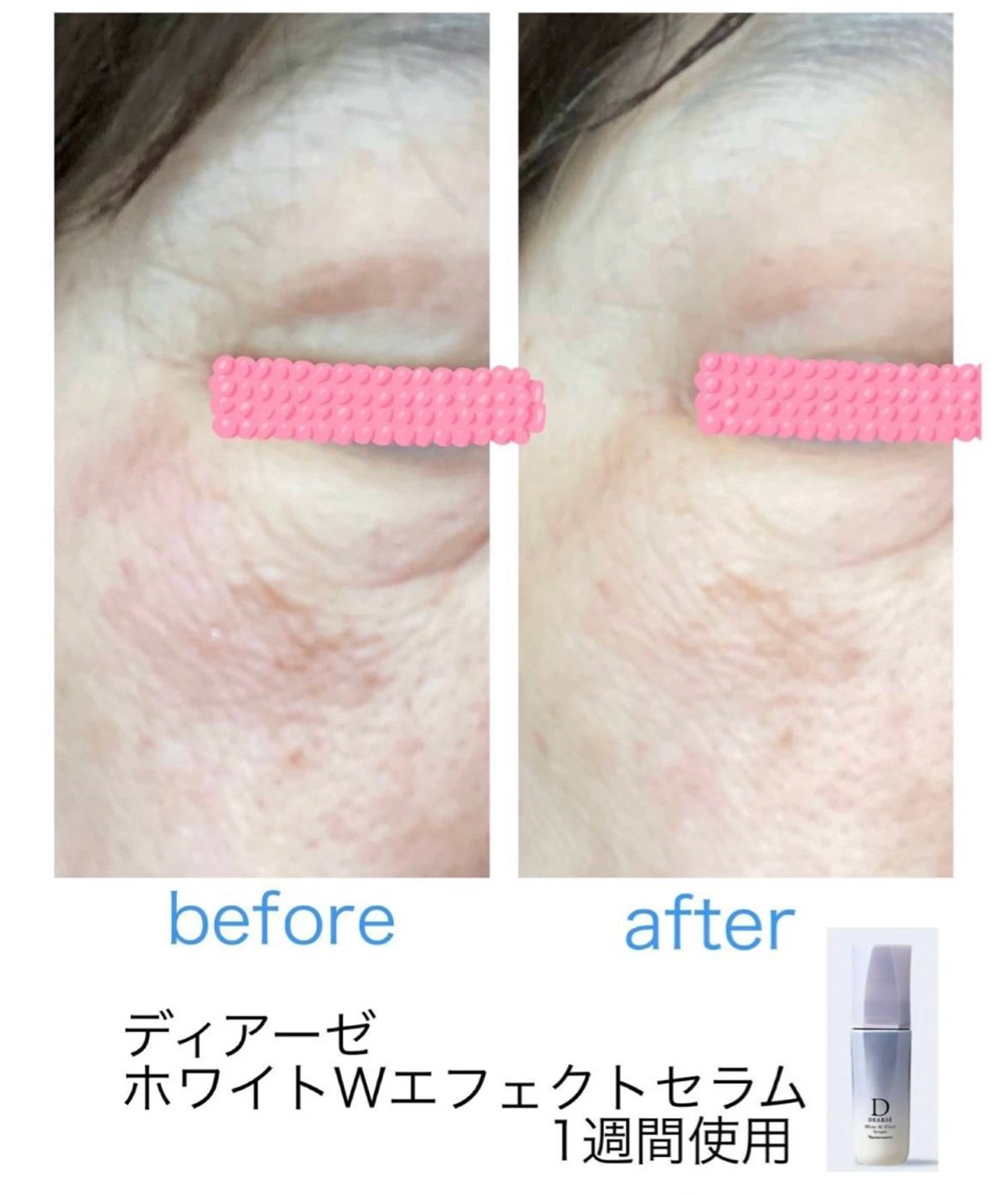 エステ ROR所属・ROR nailのエステ・リラクイメージ