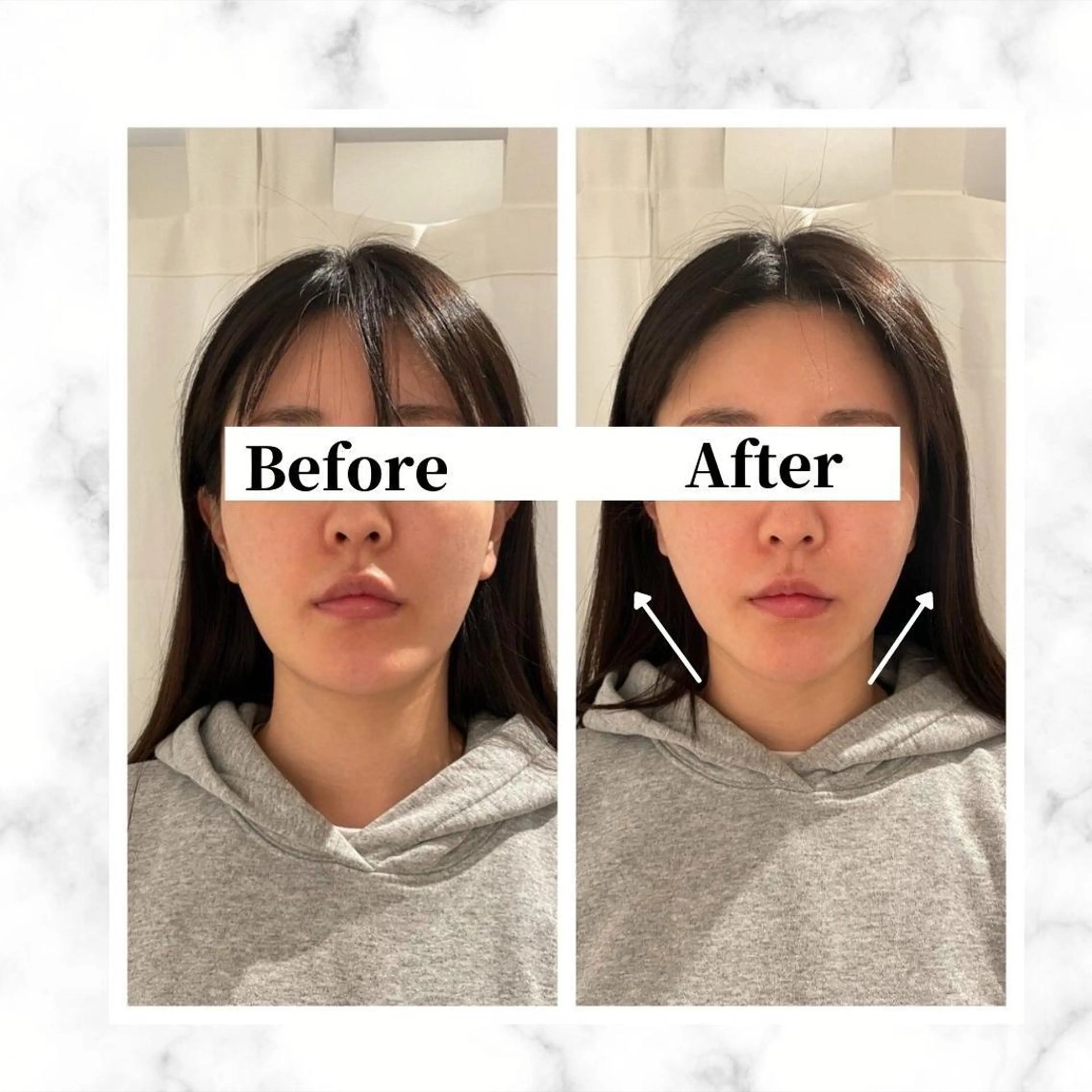 エステ リラク 12Dハイフ💗 最強小顔のエステ・リラクイメージ