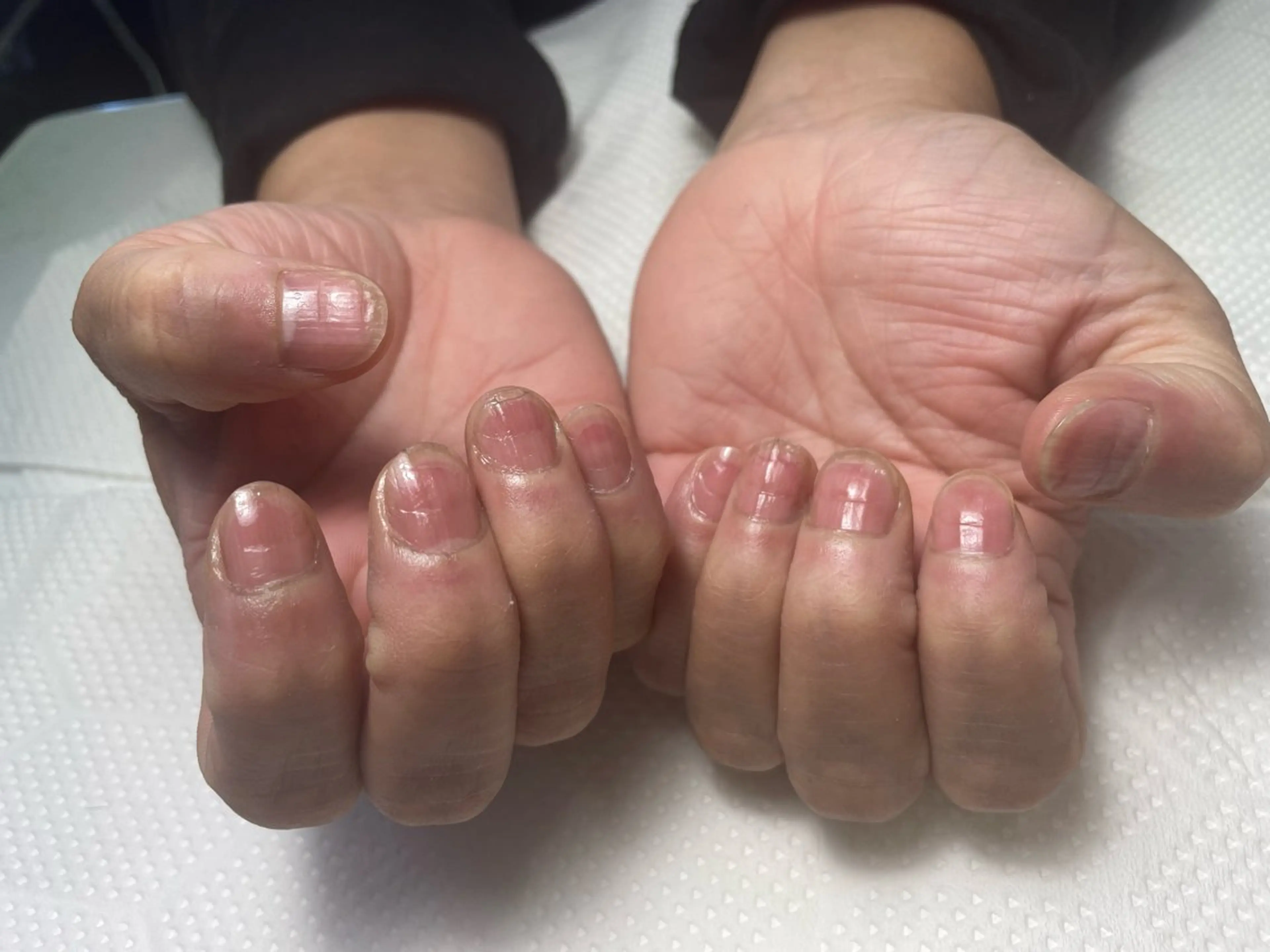 ネイル ハンドケア 美容室るーじゅ所属・美容室 るーじゅ/しいの木台のマツエク・マツパデザイン