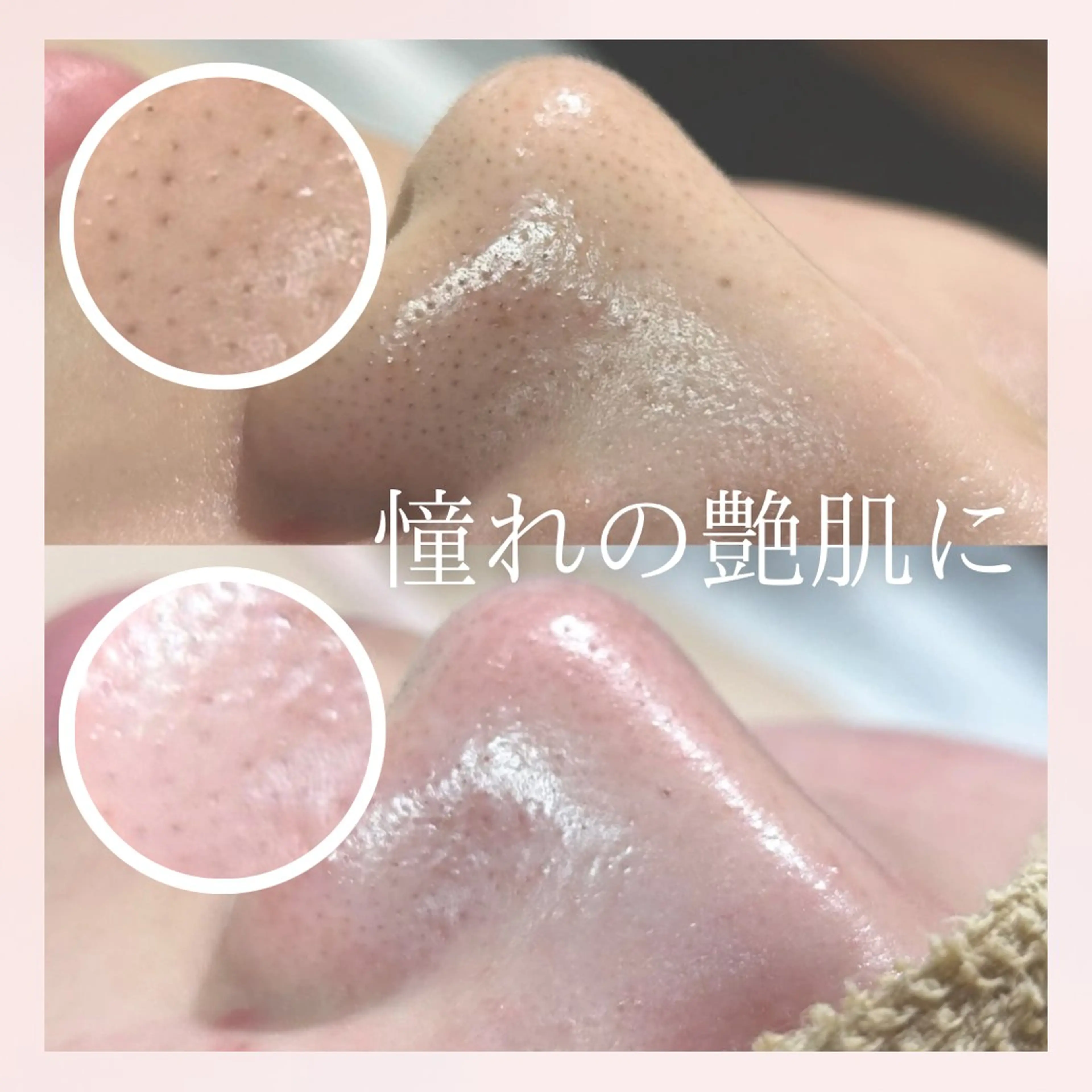 美肌脱毛&毛穴専門 Nico🐰ྀི♡のエステ・リラクイメージ