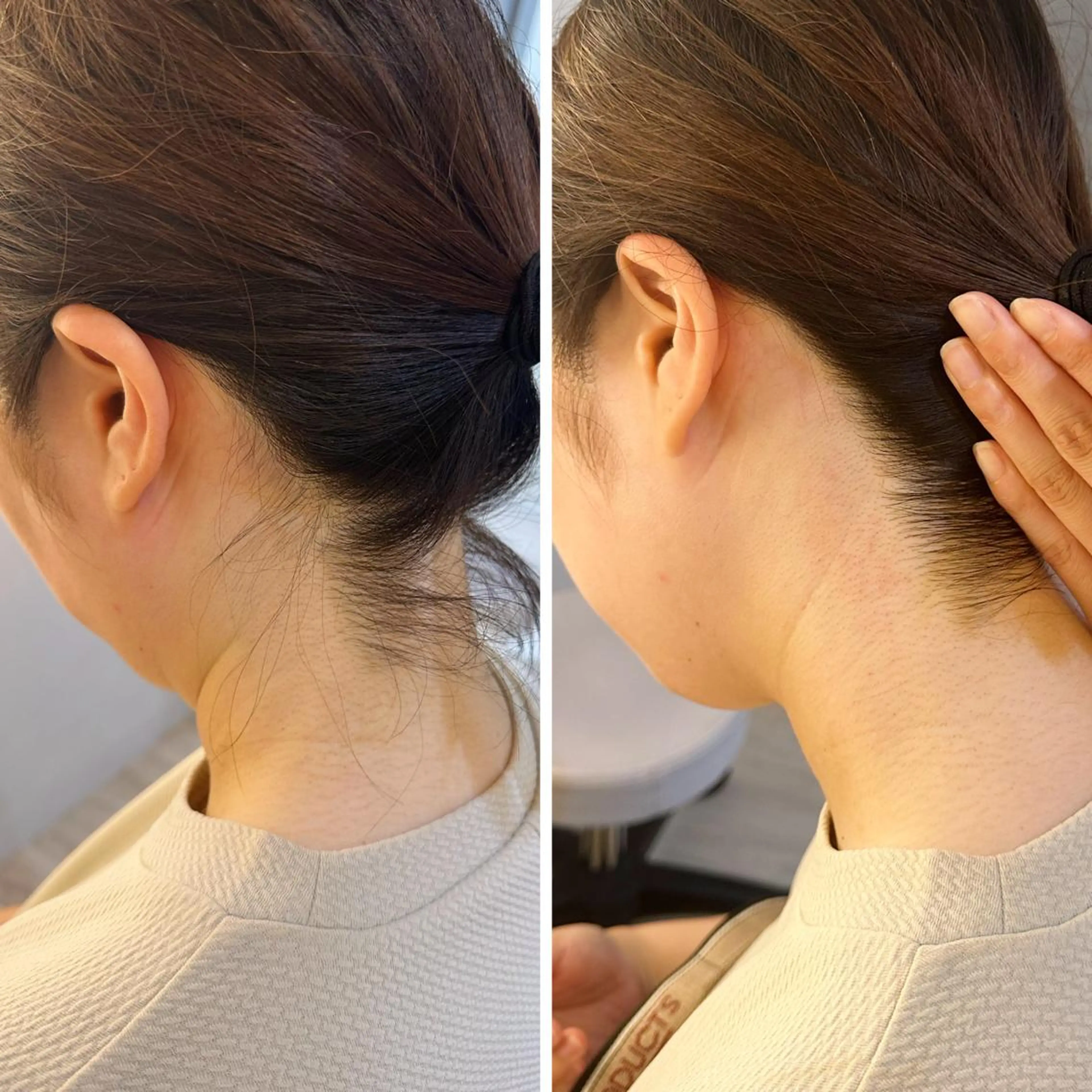 脱毛 うなじ脱毛/美肌脱毛 LABELのエステ・リラクイメージ