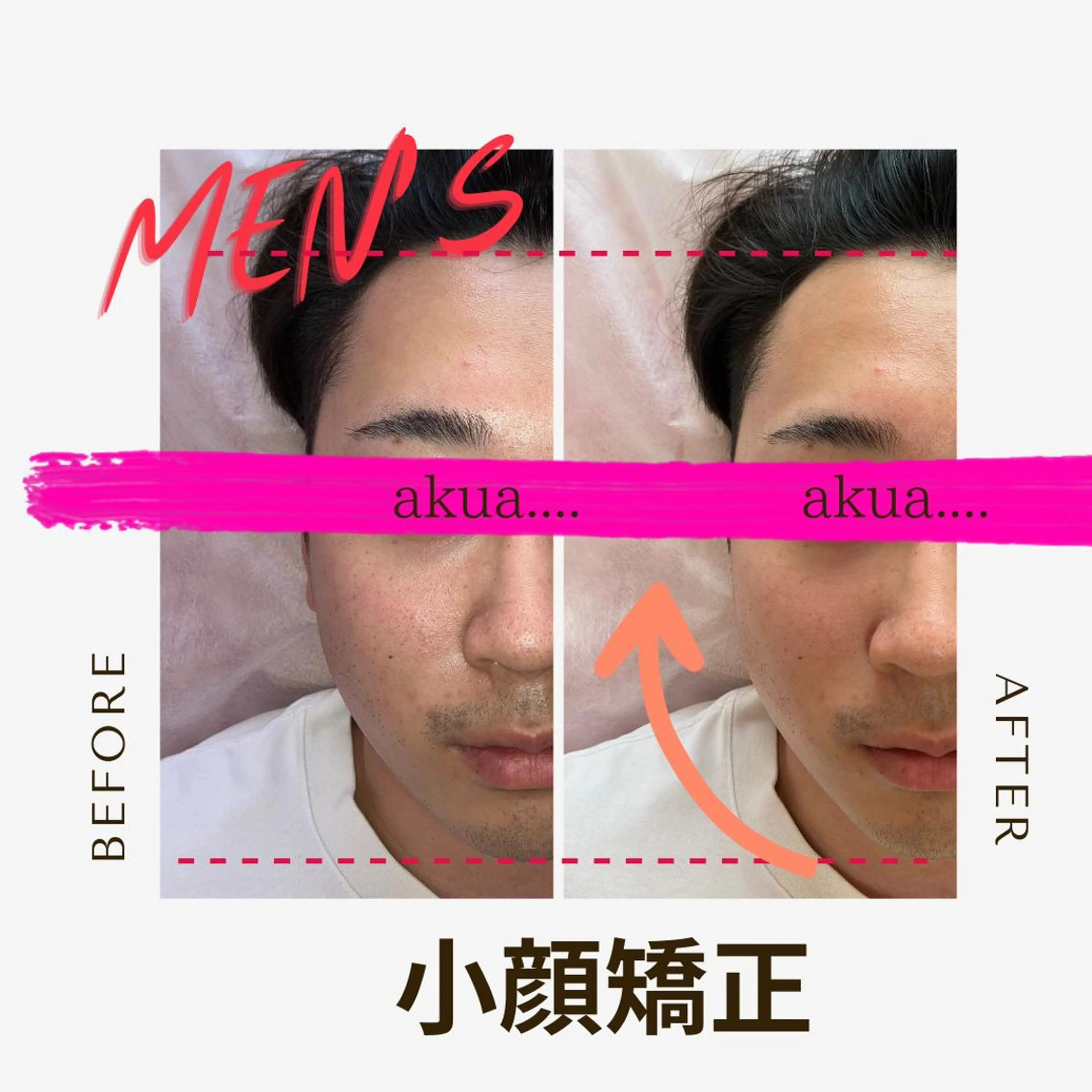 akua... 【肌質管理専門】のその他イメージ