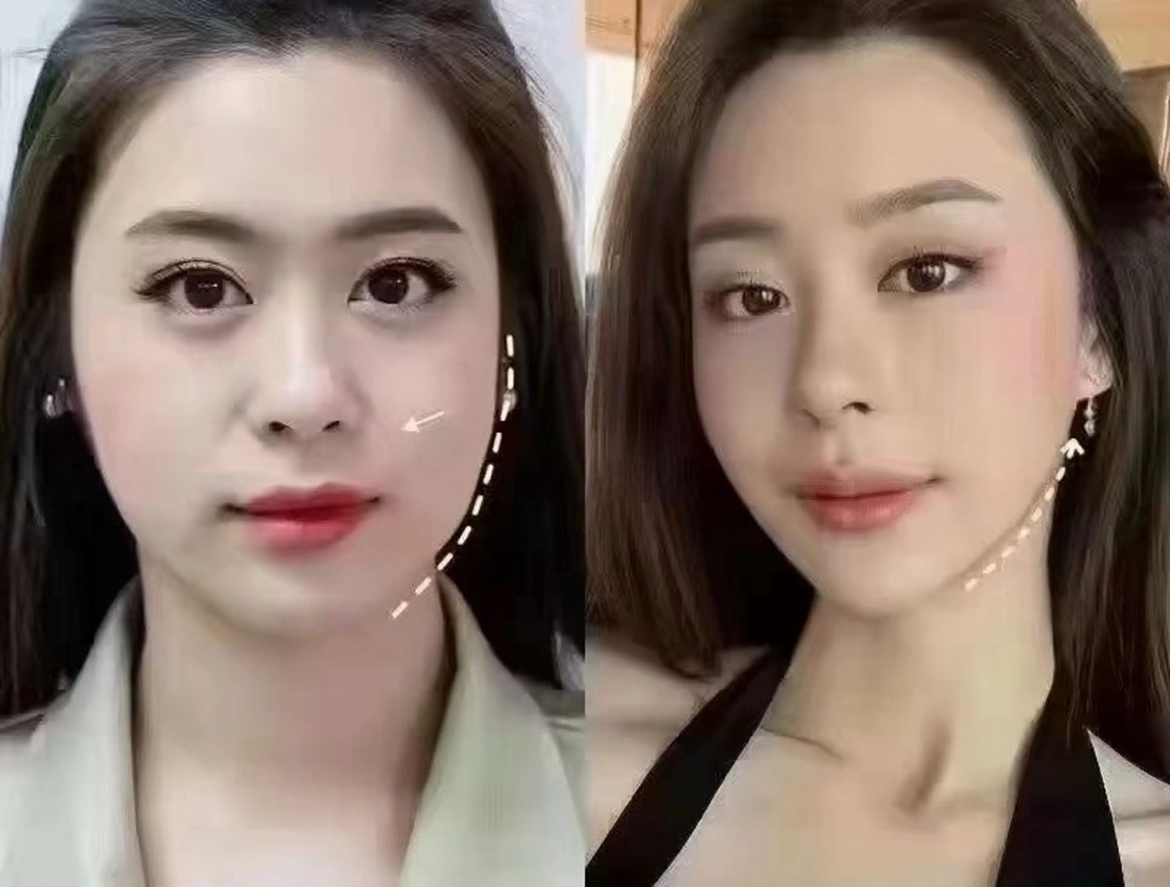 ネイル エステ aliaハイフ&水光ジェットサロン所属・aliaハーブ水光店 エステティシャン募集のエステ・リラクイメージ