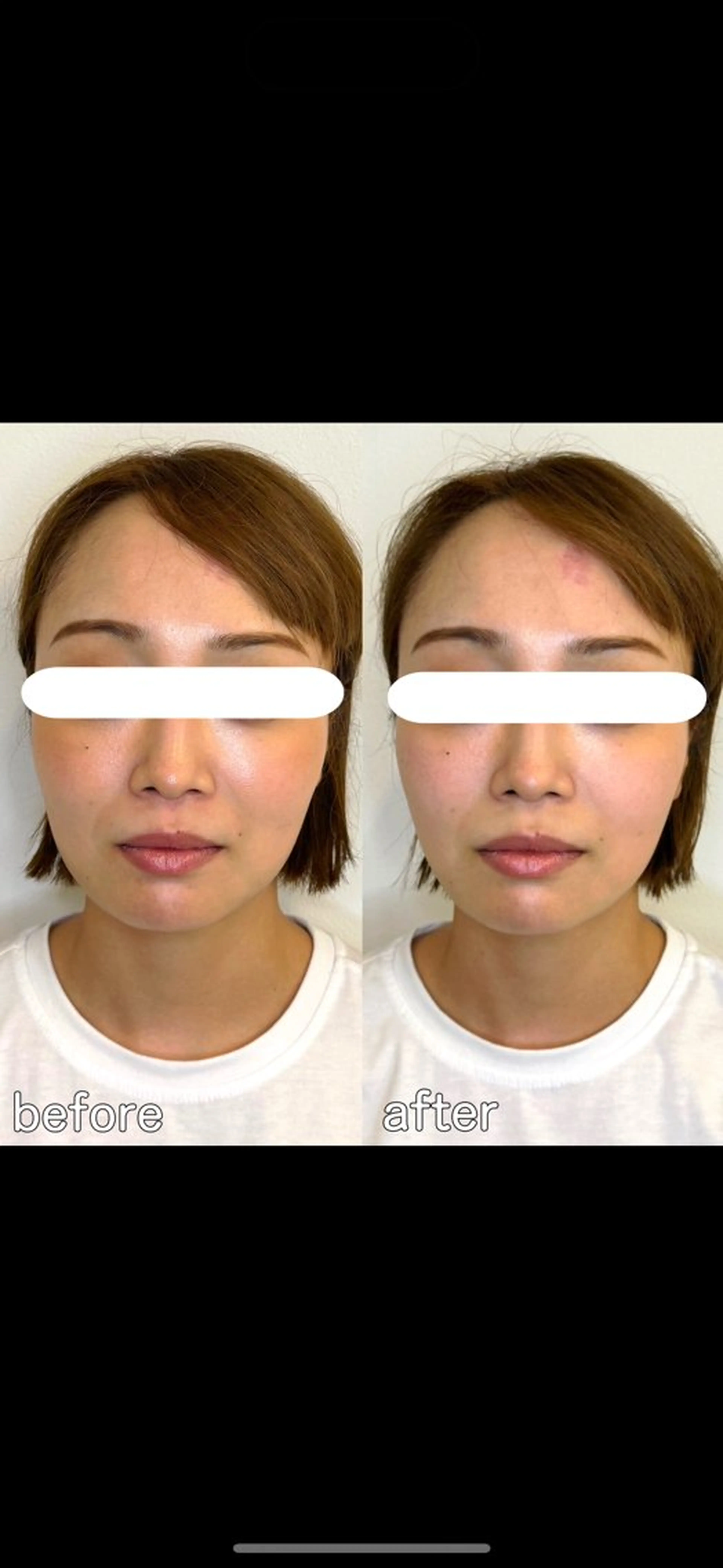 小顔矯正&美容整体 整え屋REDオーナーのエステ・リラクイメージ