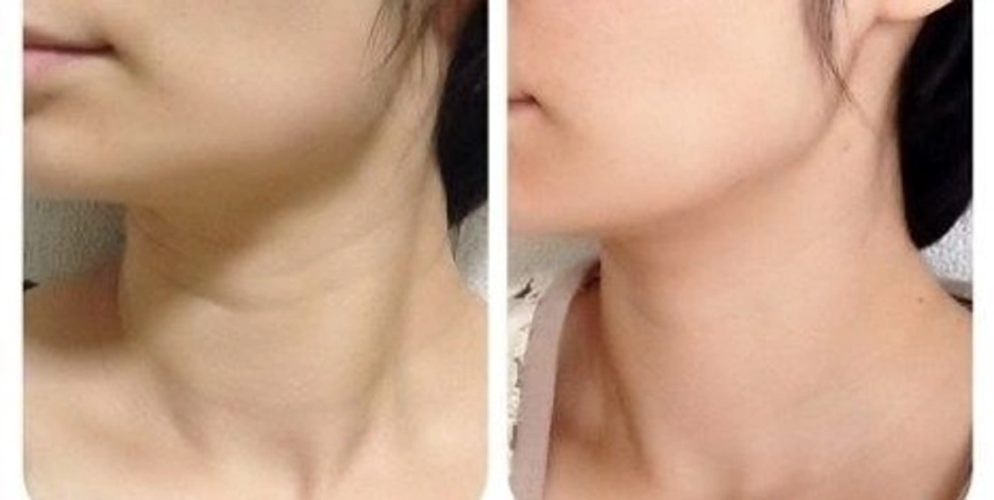 リンパ療法サロン美安 　　黒井のエステ・リラクイメージ