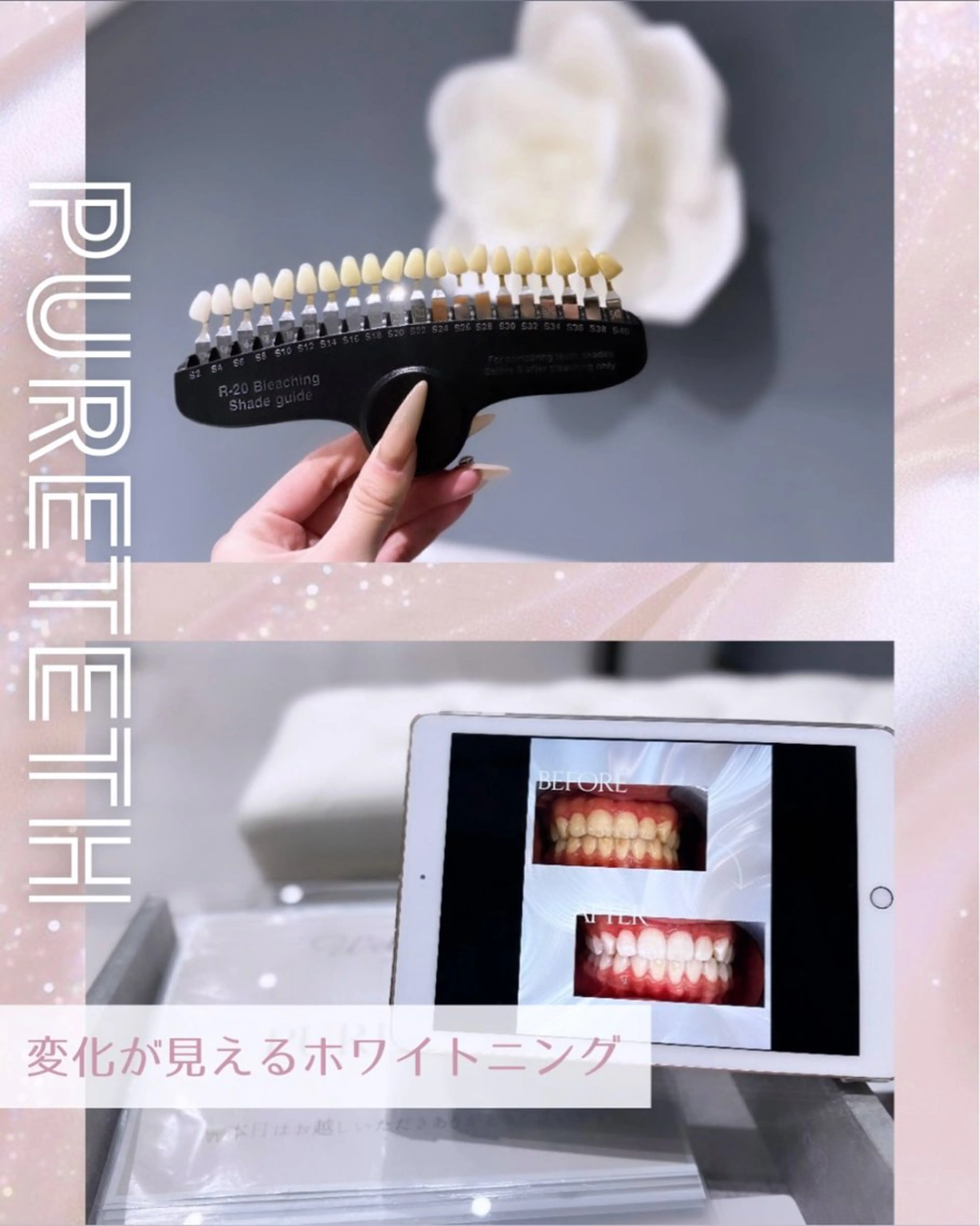 エステ ホワイトニングサロンPURETETH所属・ホワイトニングサロン PURETETHのエステ・リラクイメージ