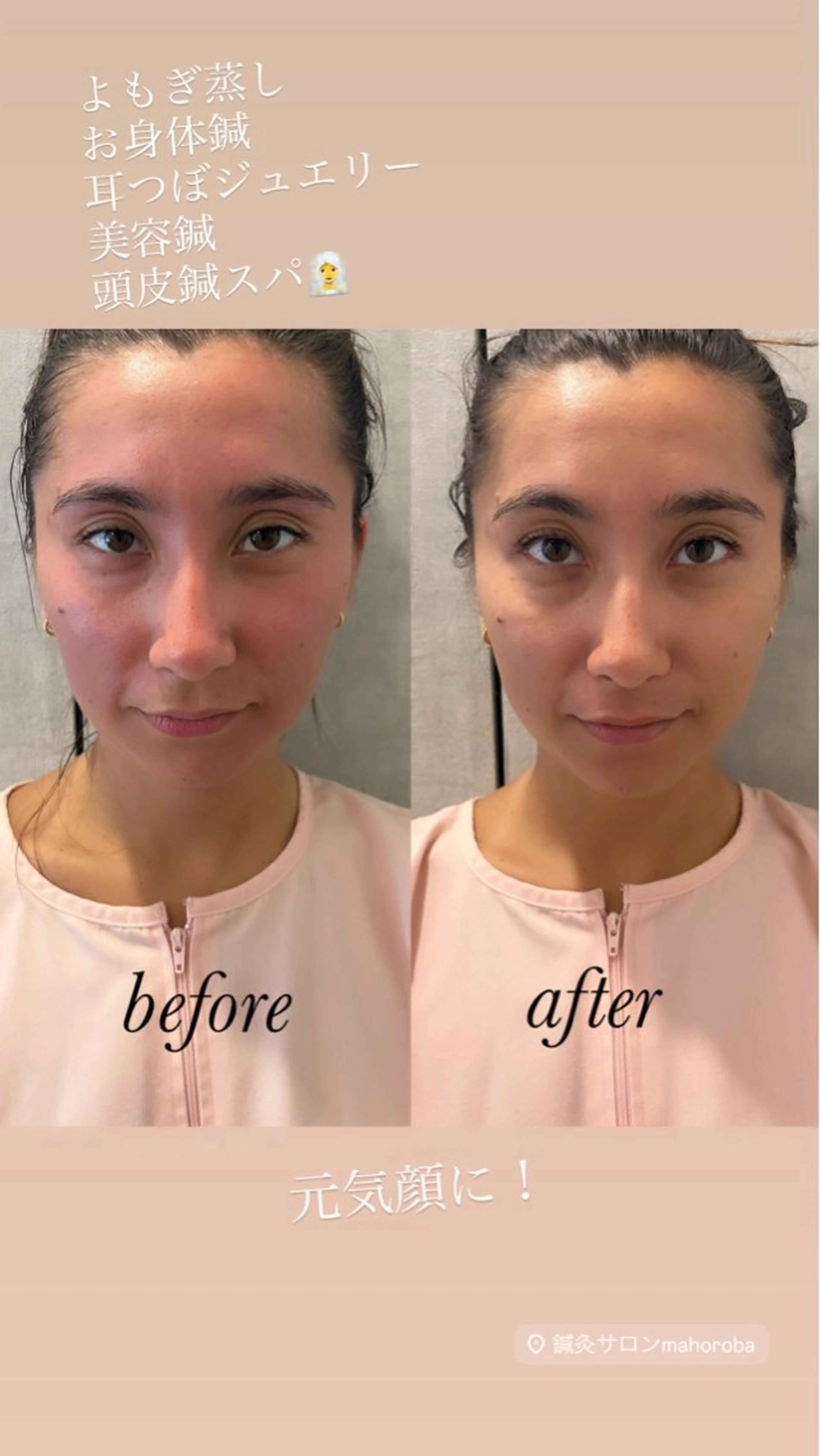 その他 美容鍼灸サロン mahoroba院長のエステ・リラクイメージ