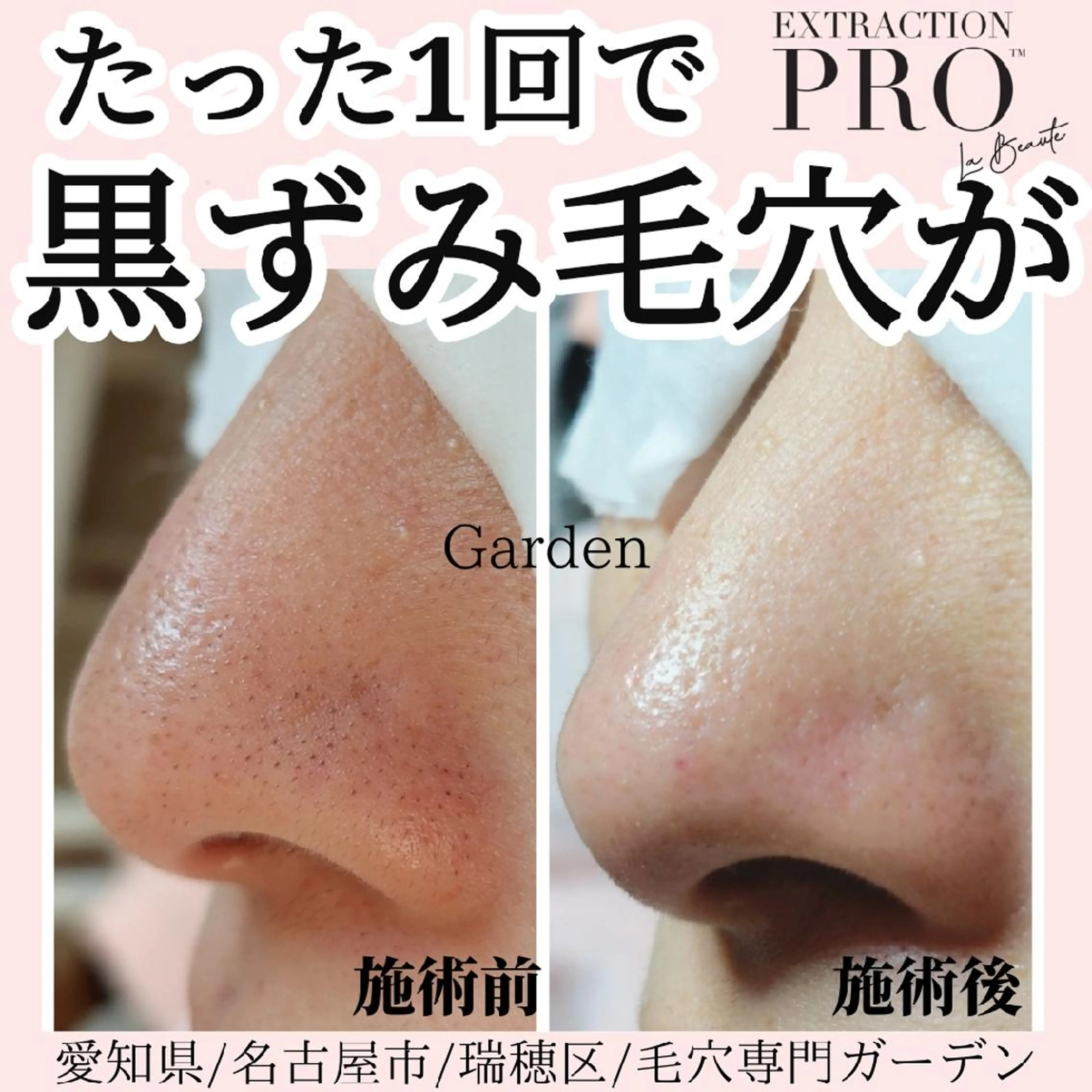 プライベートサロン Gardenのエステ・リラクイメージ