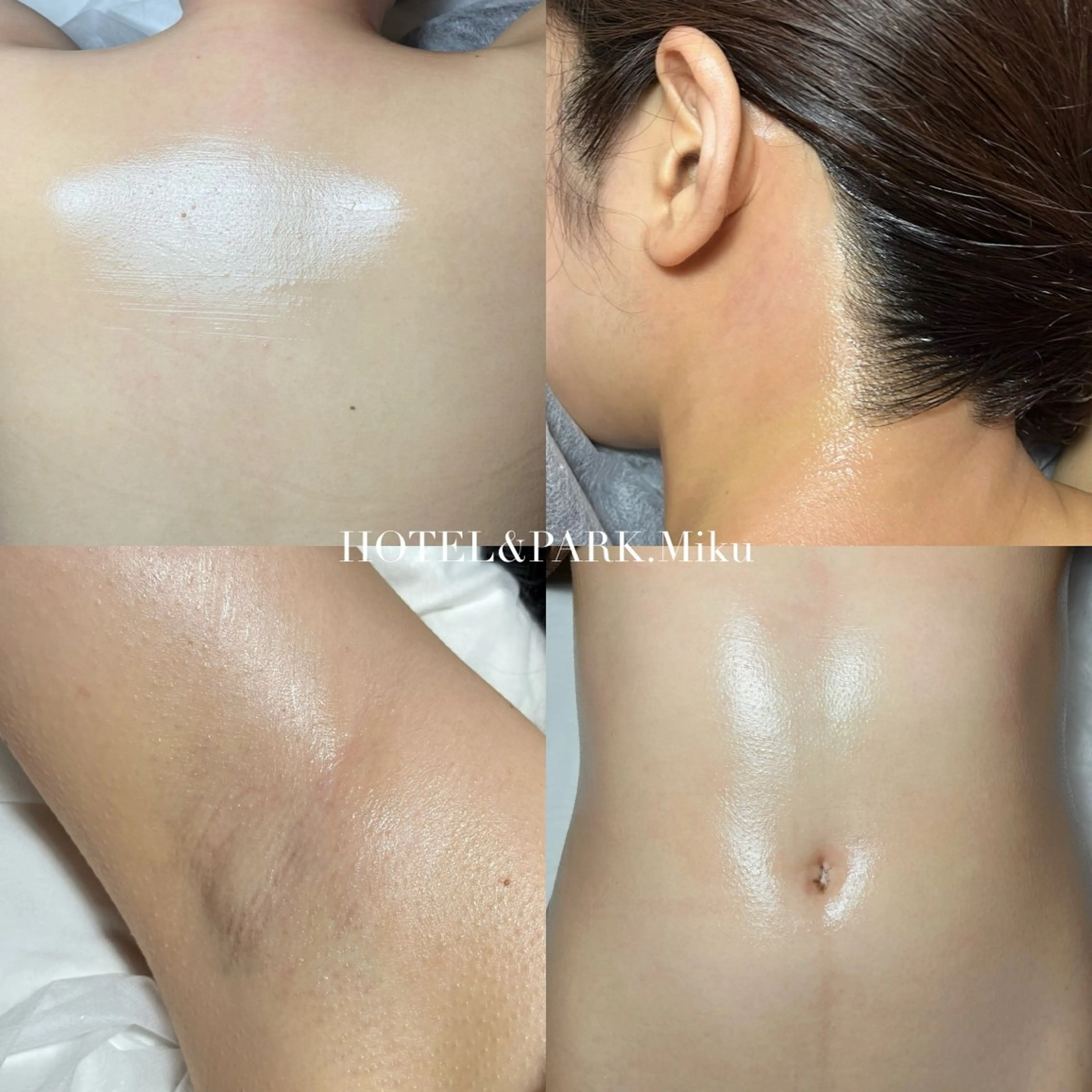 HOTEL&PARK Mikuワックス脱毛のエステ・リラクイメージ