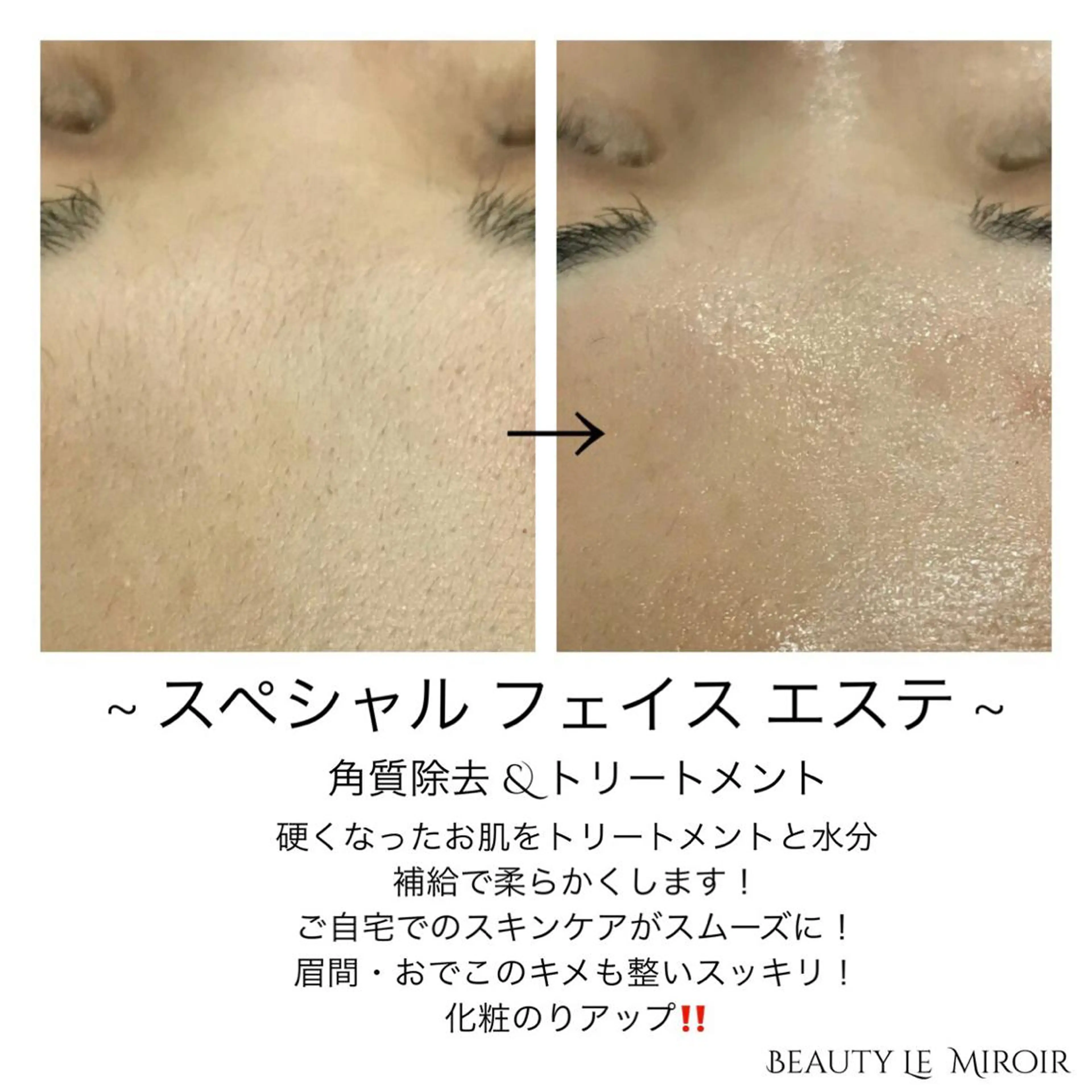 ビューティー ミロワールのエステ・リラクイメージ