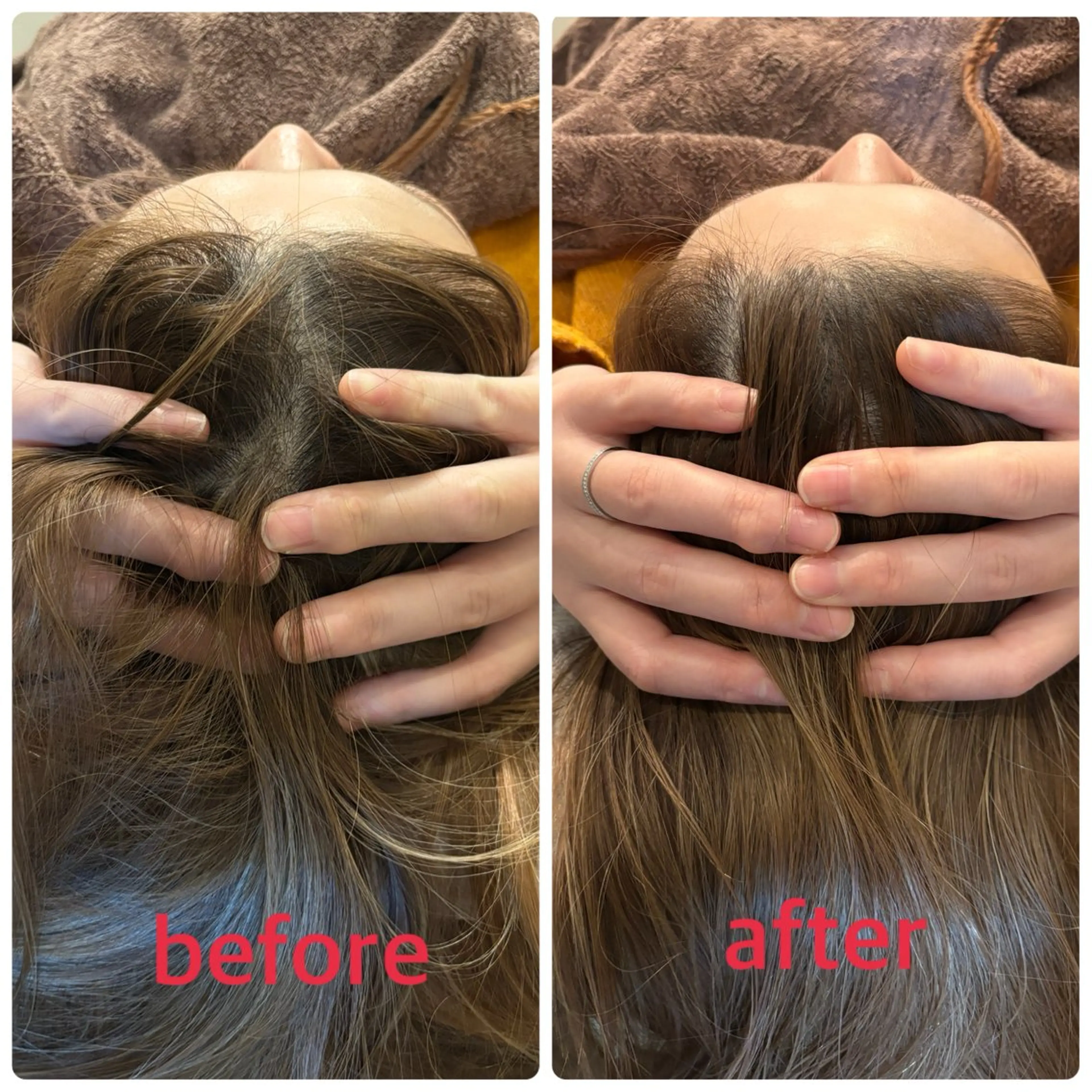 エステ リラク 小林整骨院本町 美容鍼roomのエステ・リラクイメージ