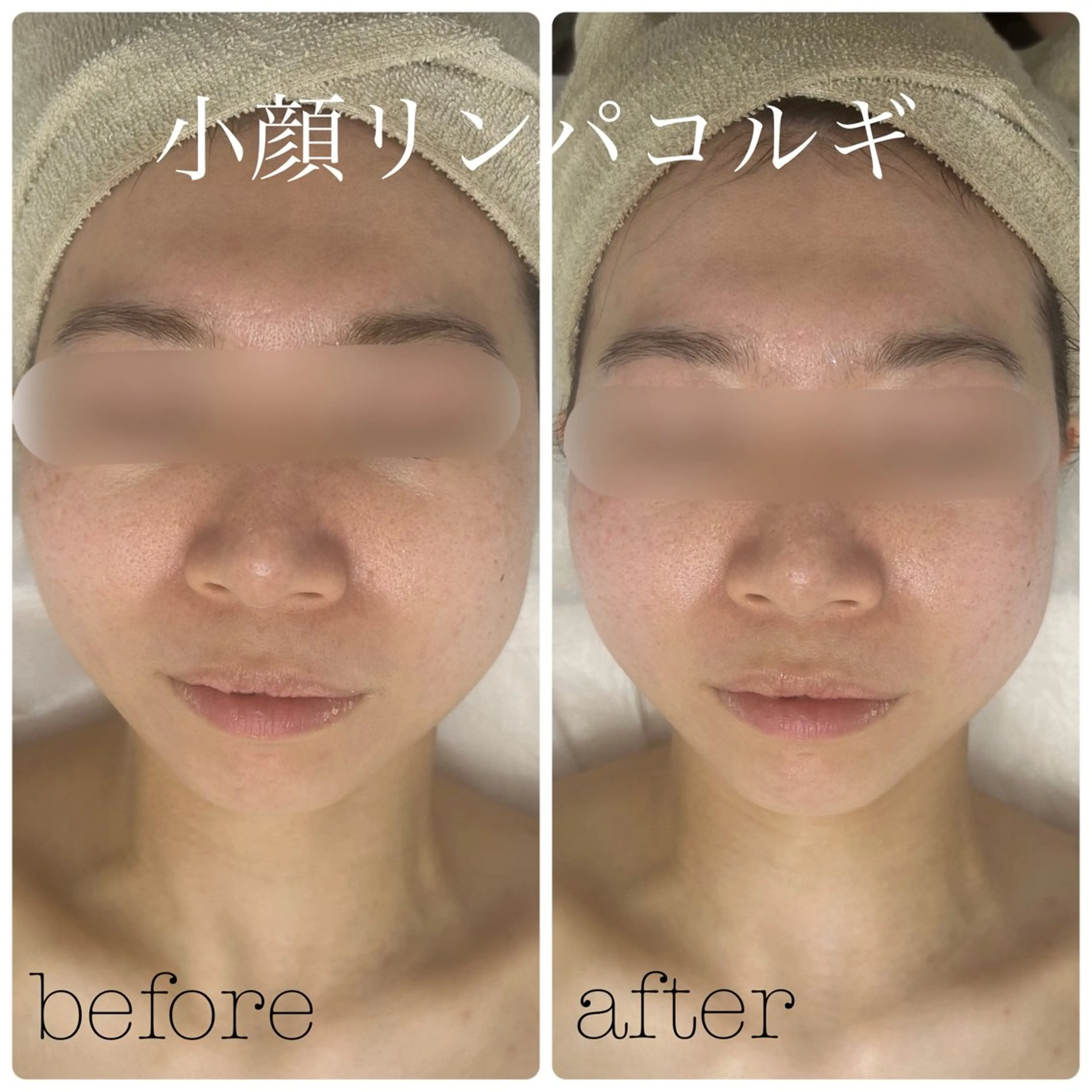 メンズ フェイシャルサロン CHIARA 荒田のエステ・リラクイメージ