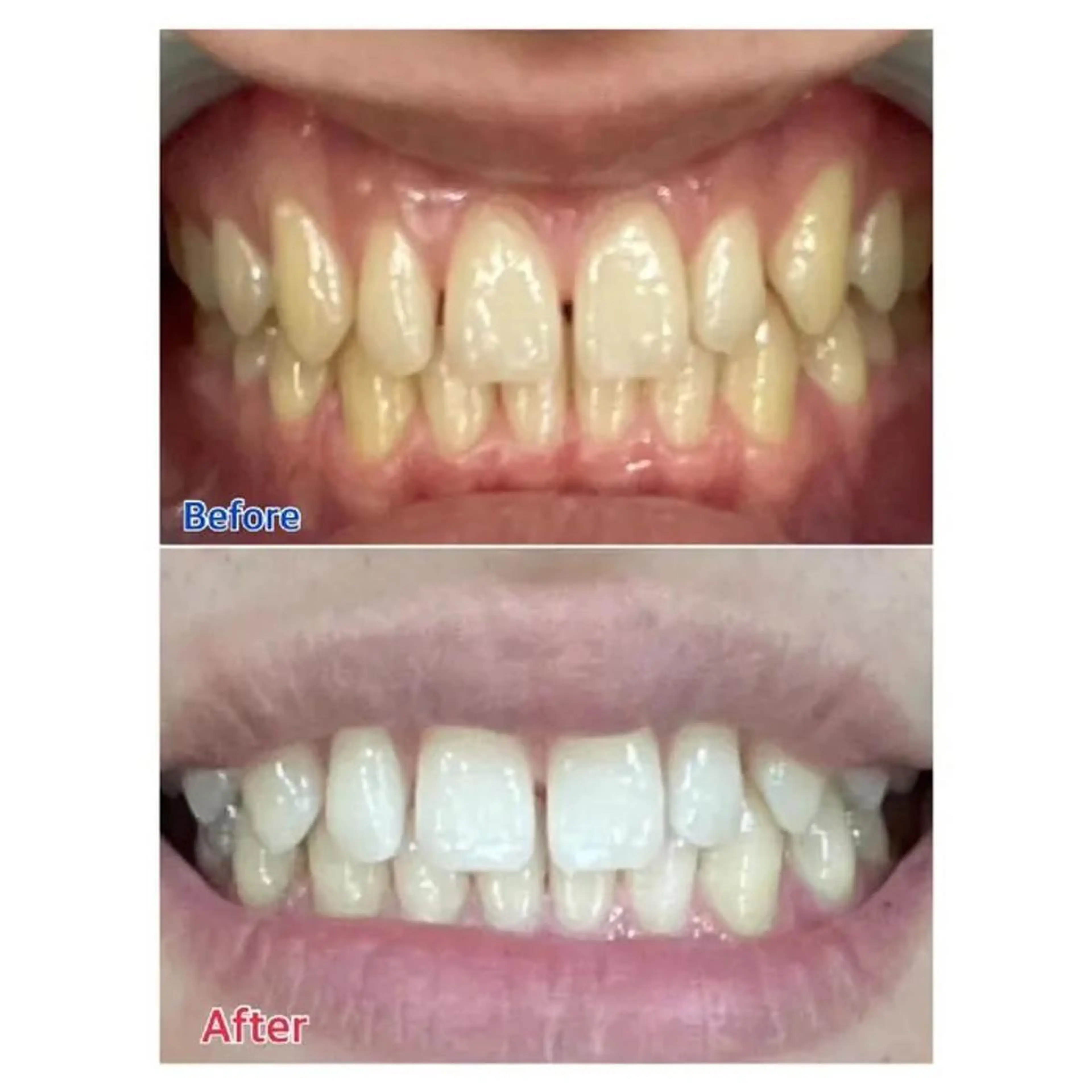 M渋谷店所属・M渋谷 ホワイトニングのエステ・リラクイメージ