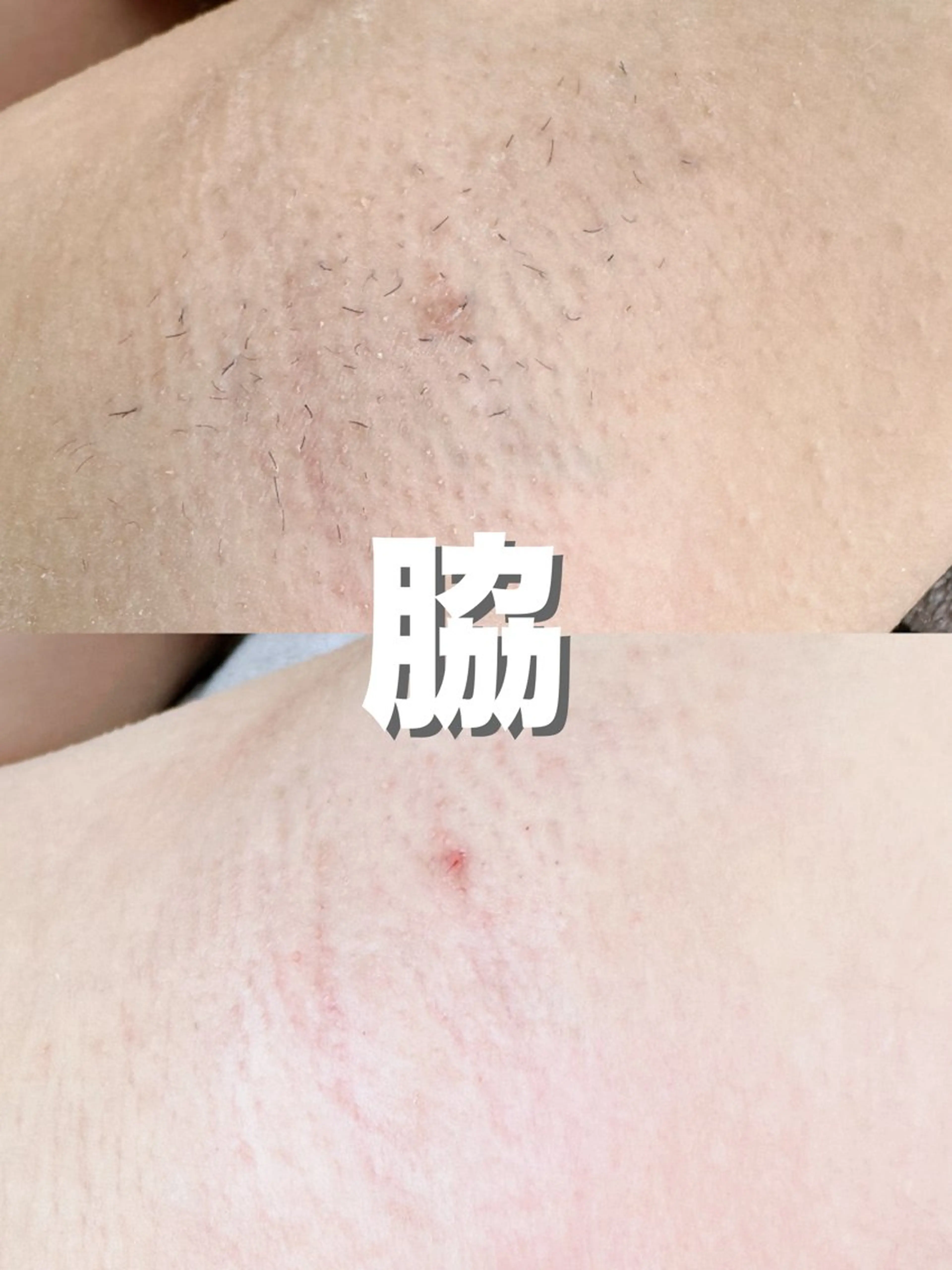 Hit. シュガーリング豊橋のエステ・リラクイメージ