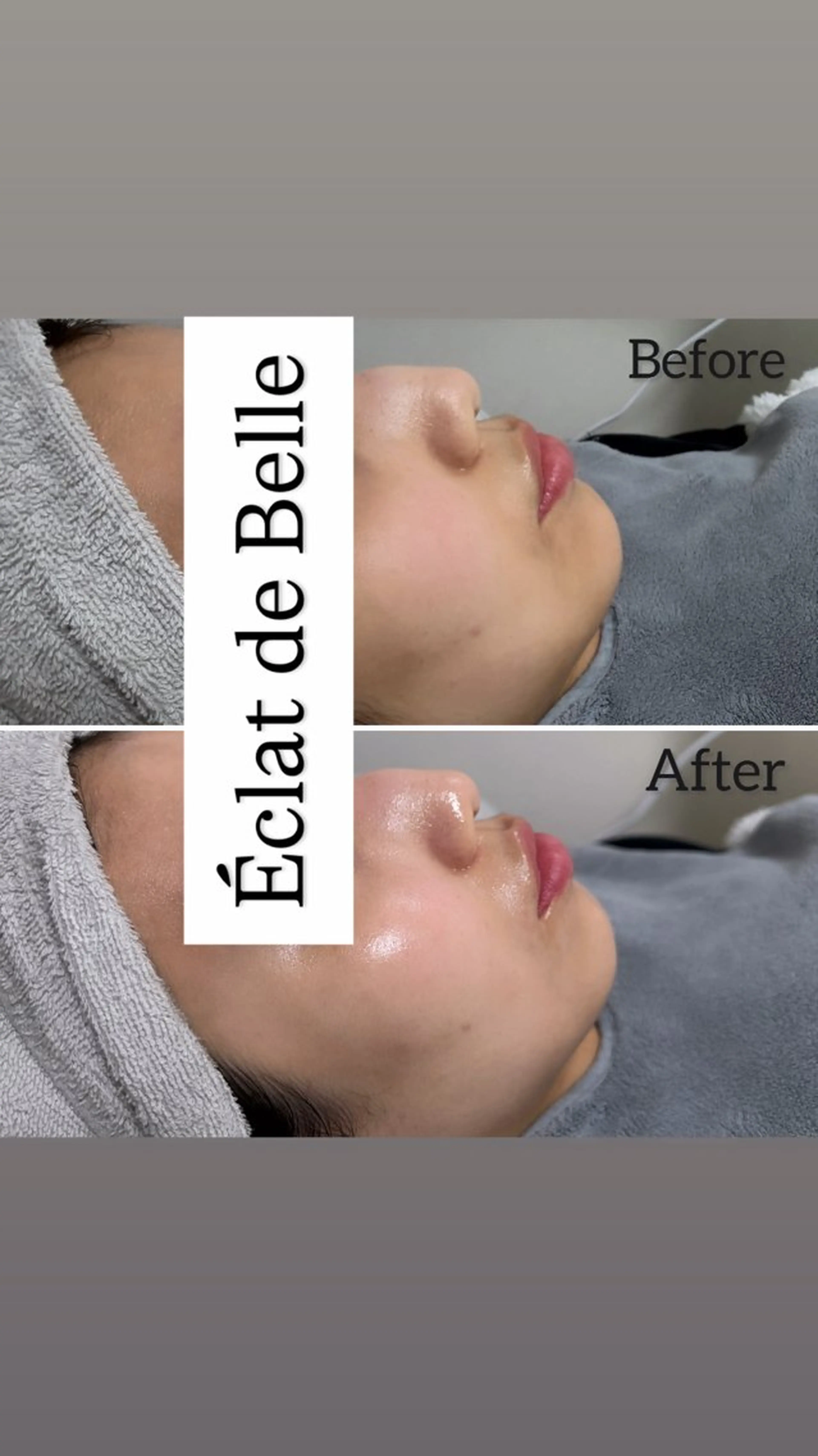 その他 Éclat de Belle🫧白玉肌のその他イメージ