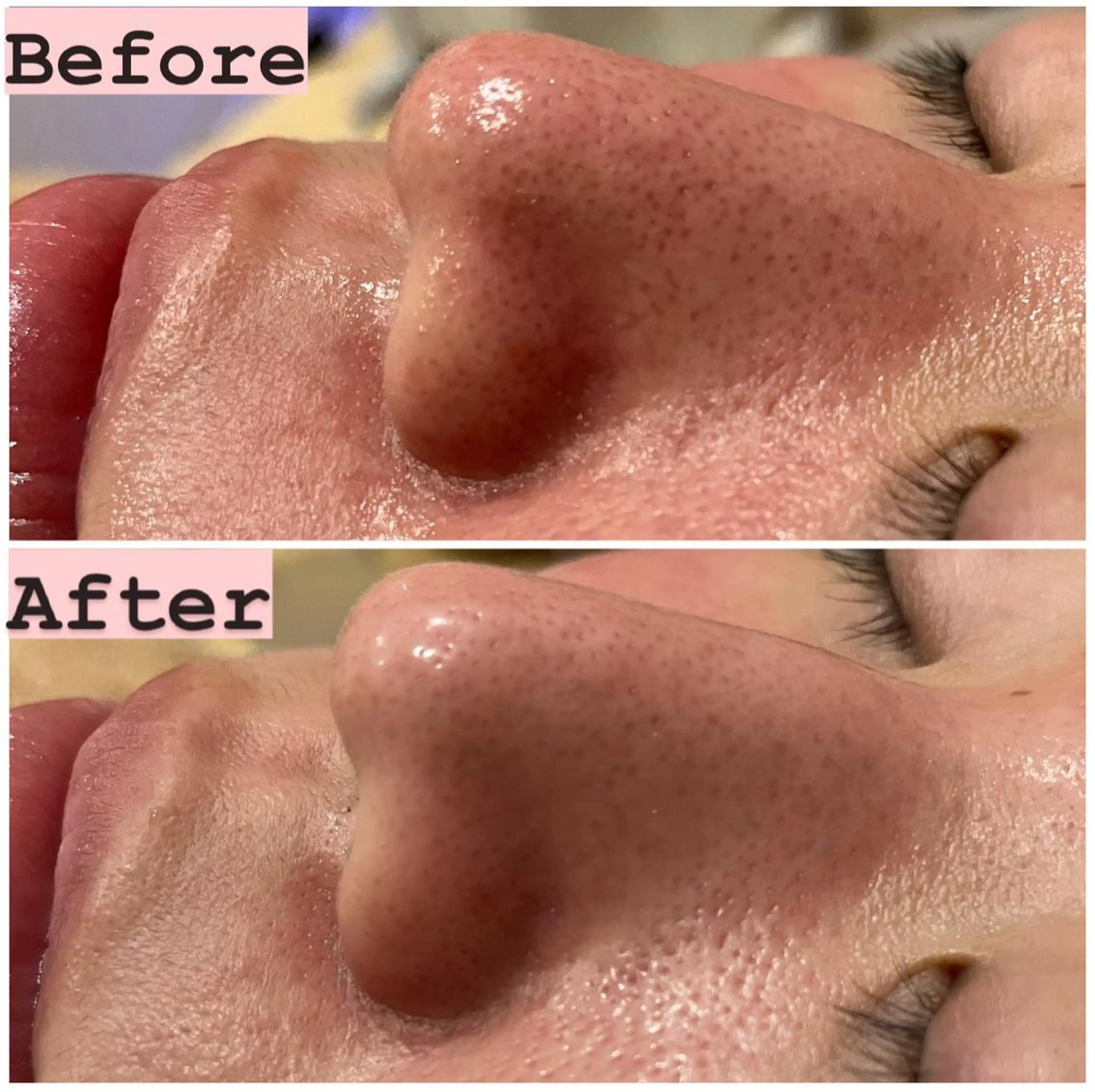 ハーブピーリング専門 muro.のエステ・リラクイメージ