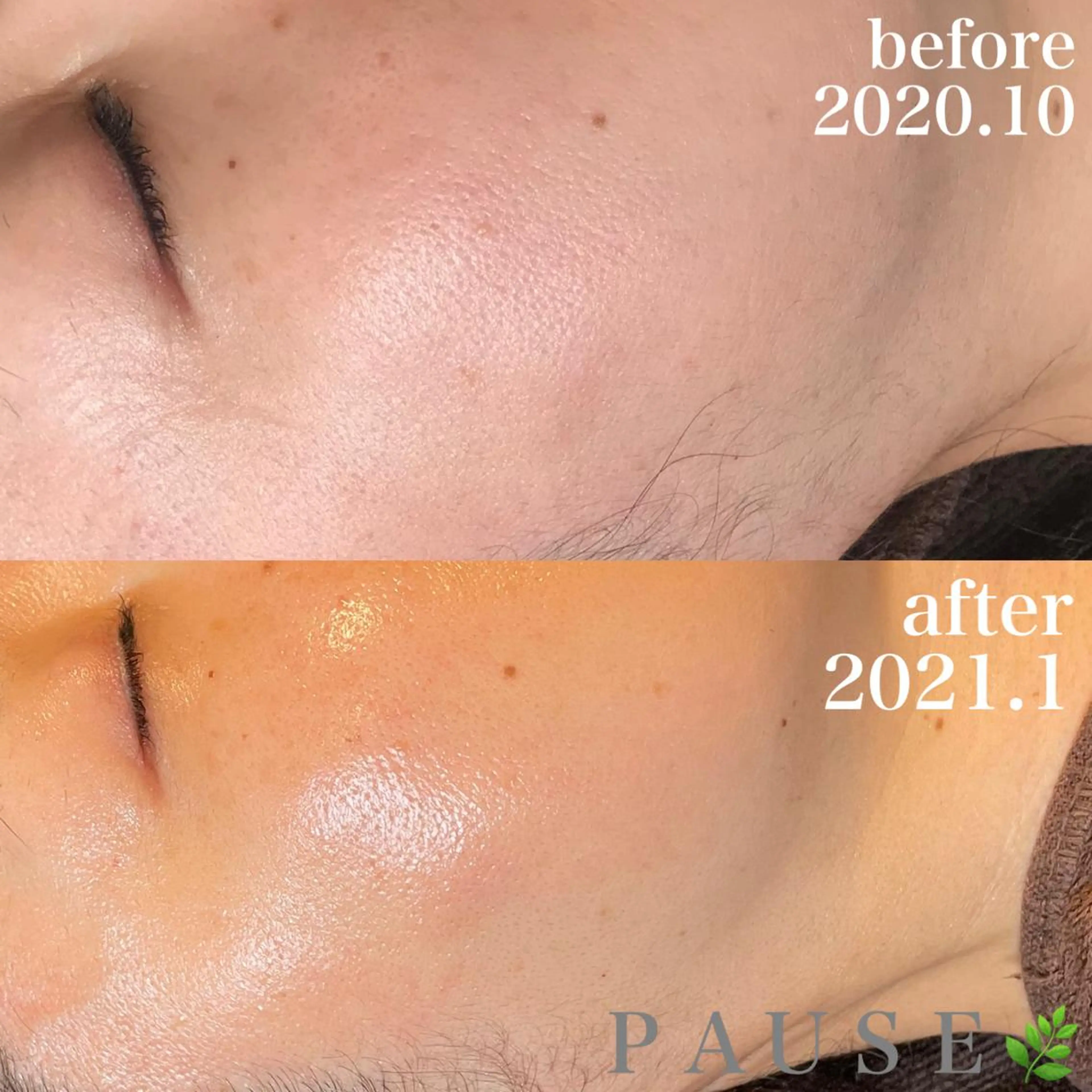 エステ 浜野 恵美のエステ・リラクイメージ